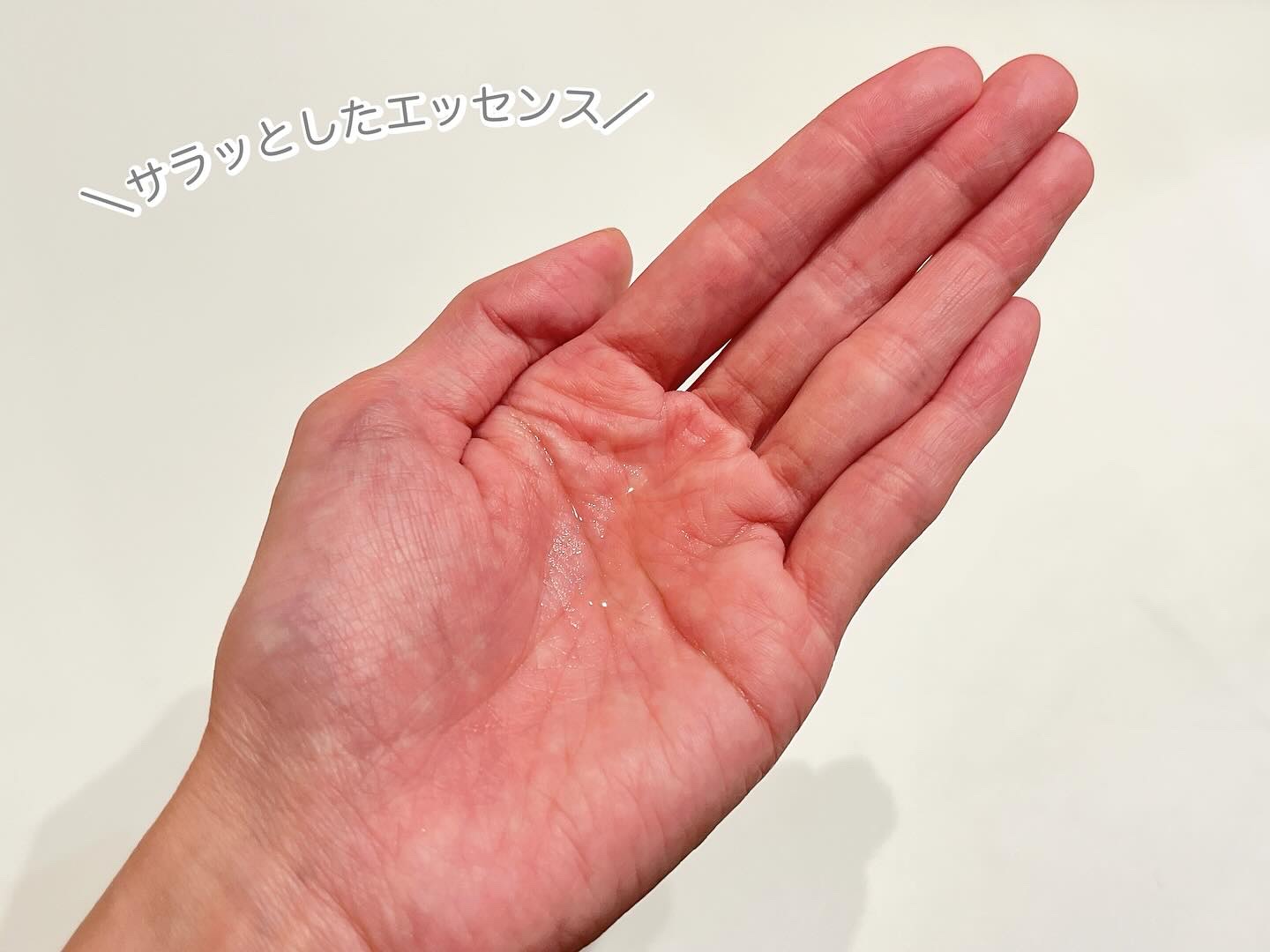 アデノバイタル スカルプ パワーショット/サブリミック/頭皮ローションを使ったクチコミ（3枚目）