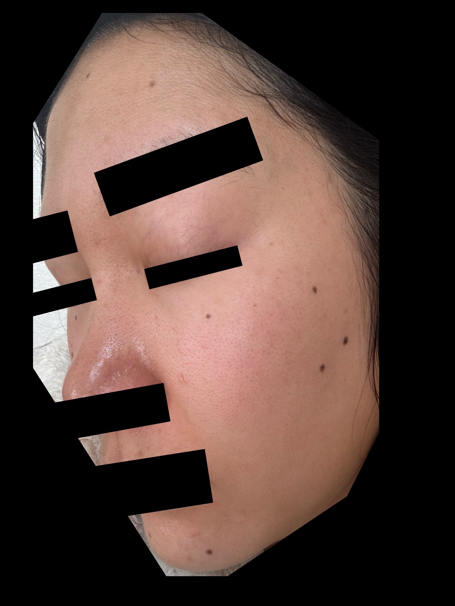 ホワイトショット ホワイトショット SXS Nのクチコミ「過去一汚い。。
何とかしたいな。。
Hakuを戻すか。。..」（3枚目）