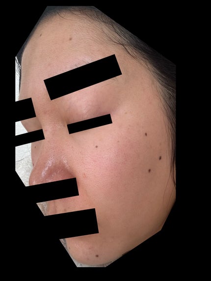 ホワイトショット SXS N/ホワイトショット/美容液を使ったクチコミ(3枚目)