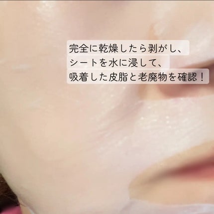 トラブルパッチマスク/EIOM/その他スキンケアを使ったクチコミ(4枚目)