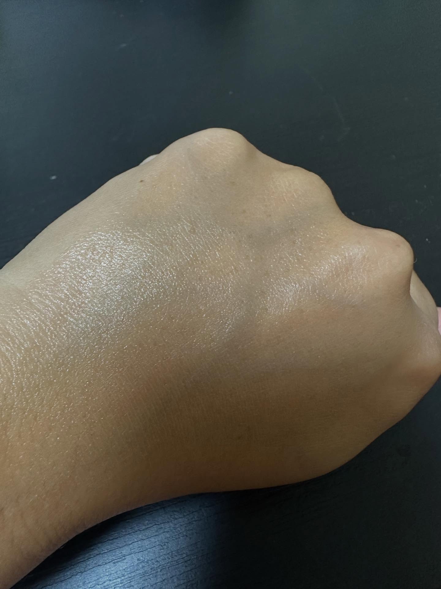 ノスカナイン トラブル セラム/FATION/美容液を使ったクチコミ（2枚目）