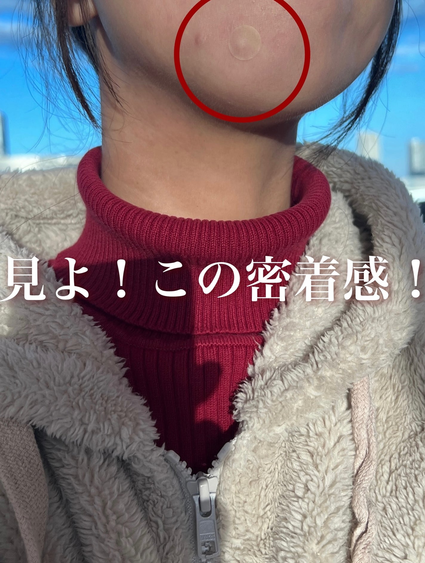 バンドエイド 顔用パッチ/バンドエイド/その他スキンケアを使ったクチコミ(4枚目)