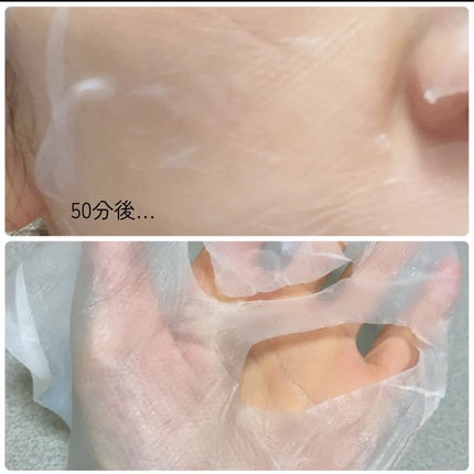 トラブルパッチマスク/EIOM/その他スキンケアを使ったクチコミ(5枚目)