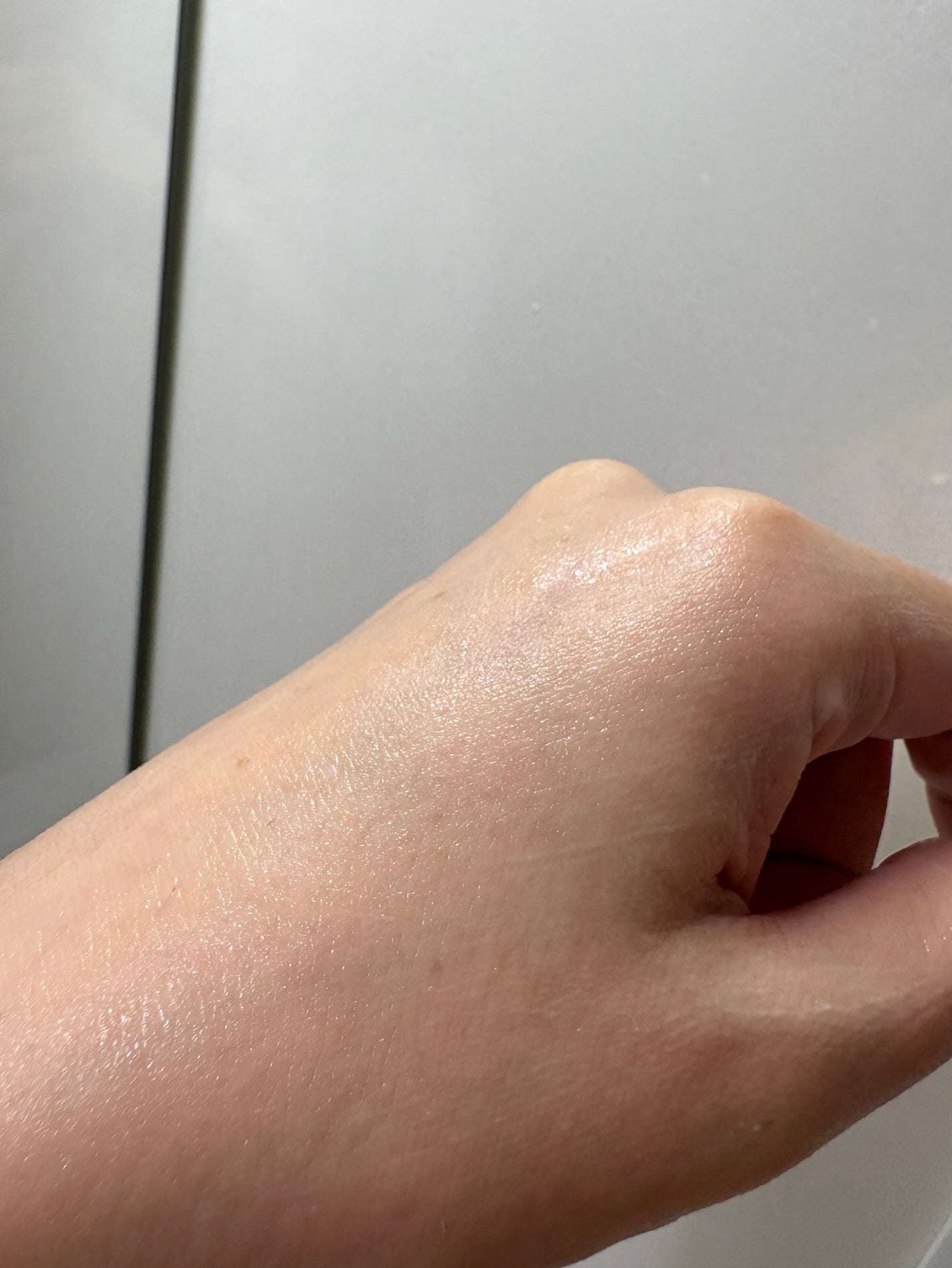 セタフィル ジェントルSAクレンザー/セタフィル/ピーリングを使ったクチコミ(5枚目)