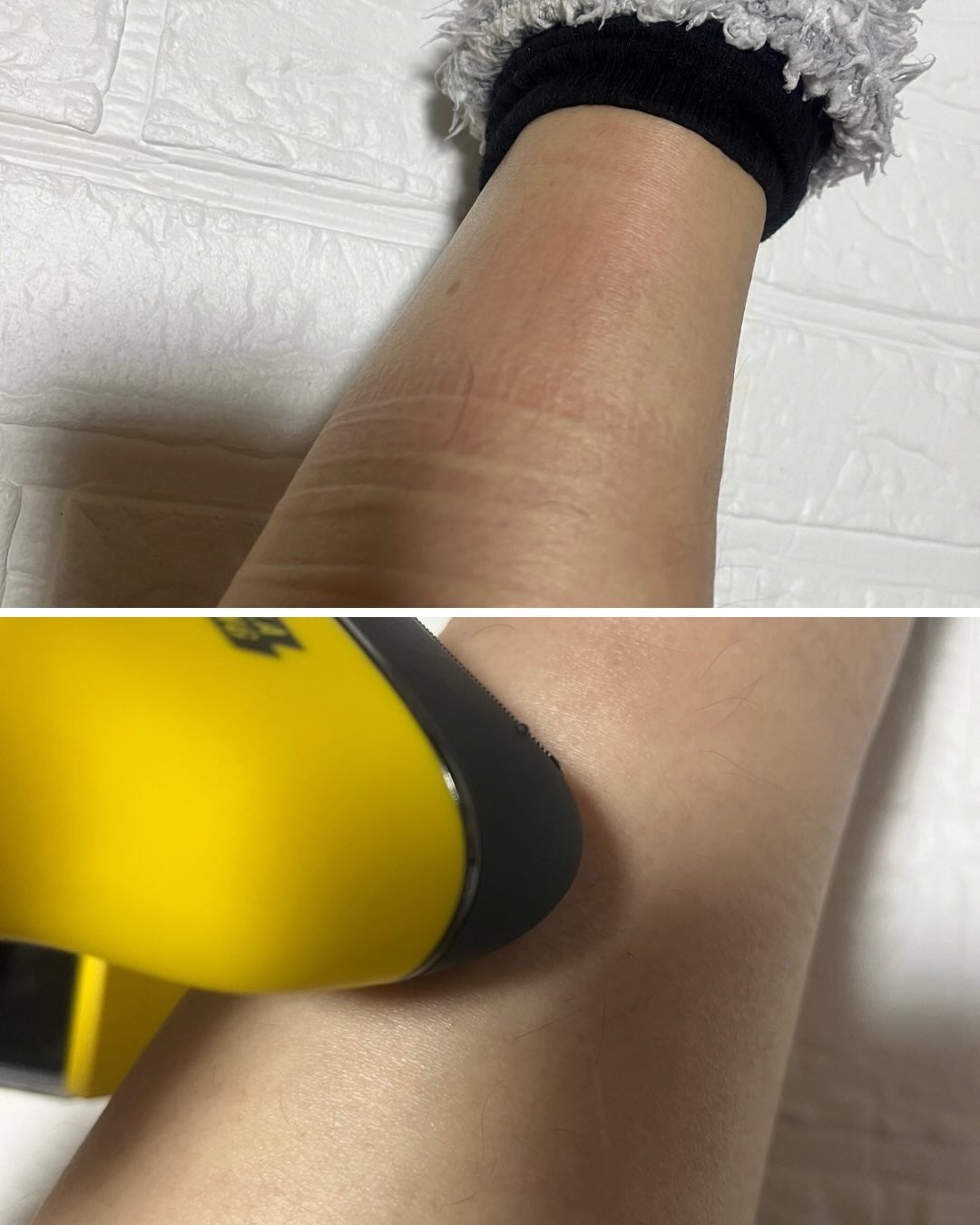 3 in 1脱毛器 (ボディ用脱毛器)/PURPLE GORILLA/家庭用脱毛器を使ったクチコミ(5枚目)