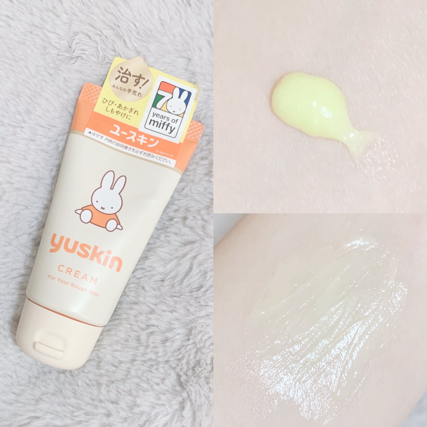 ユースキン/ユースキン/ボディクリームを使ったクチコミ(3枚目)