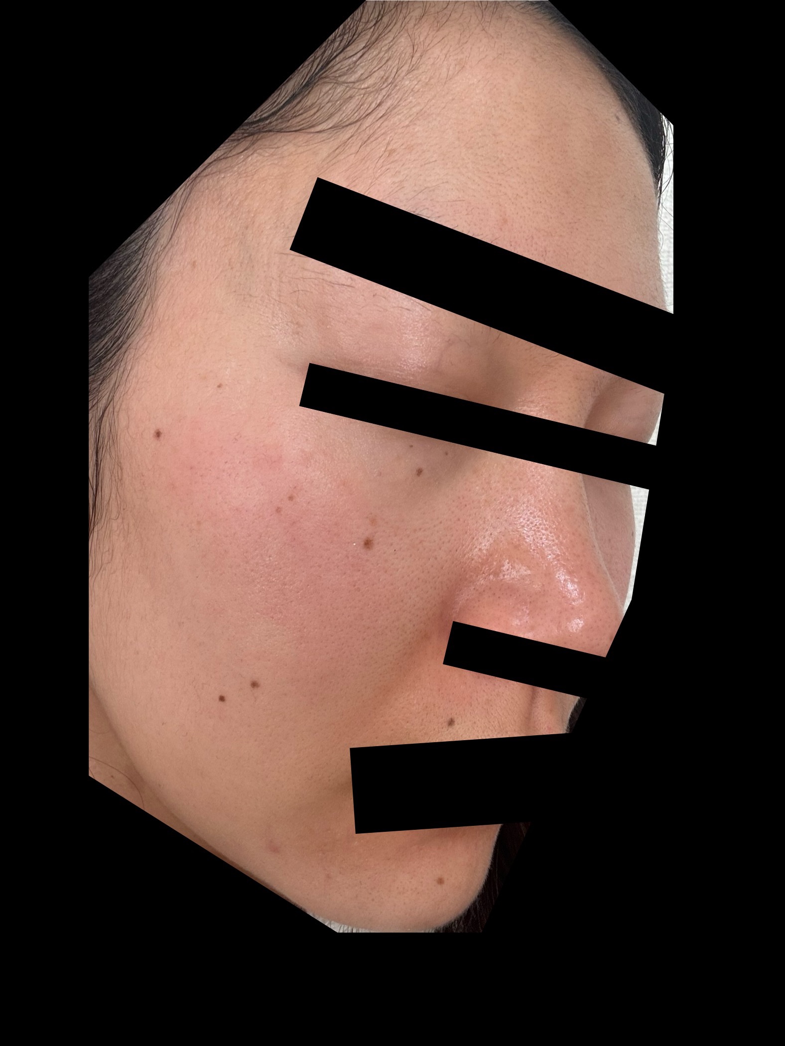 ホワイトショット ホワイトショット SXS Nのクチコミ「過去一汚い。。
何とかしたいな。。
Hakuを戻すか。。..」（2枚目）