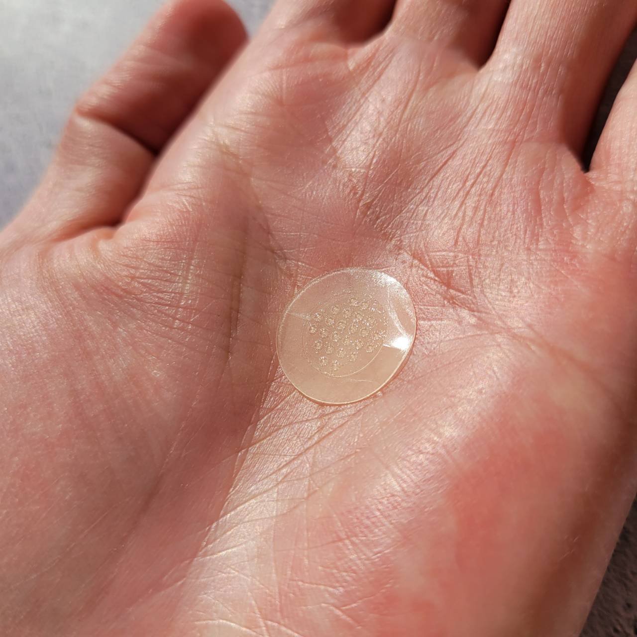 エイシーケアNE/ACROPASS/その他スキンケアを使ったクチコミ（3枚目）