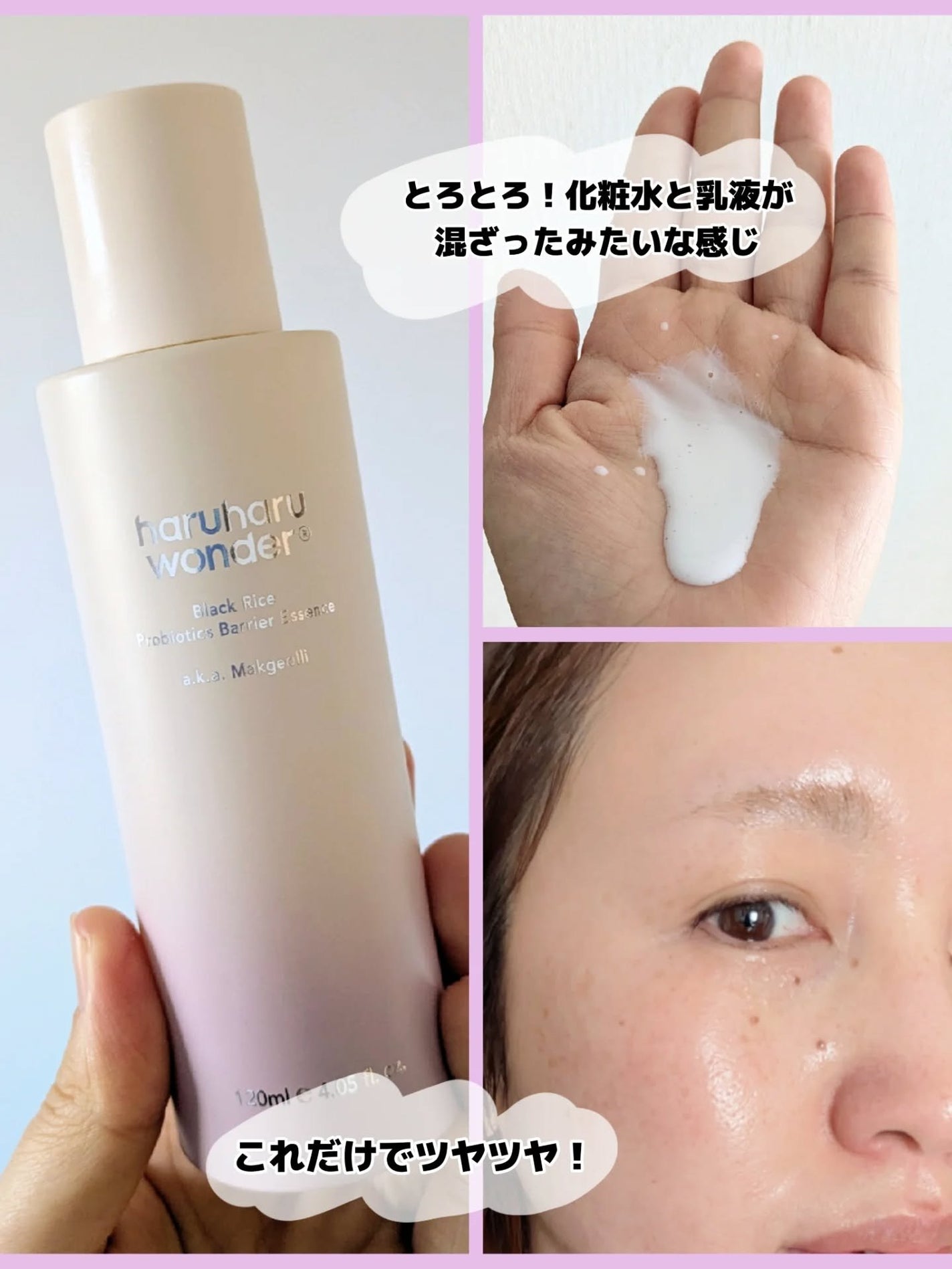 みそだんごちゃん on LIPS 「ハルハルワンダーの新作はバラのPDRN配合!さらにアゼライン酸..」(5枚目)