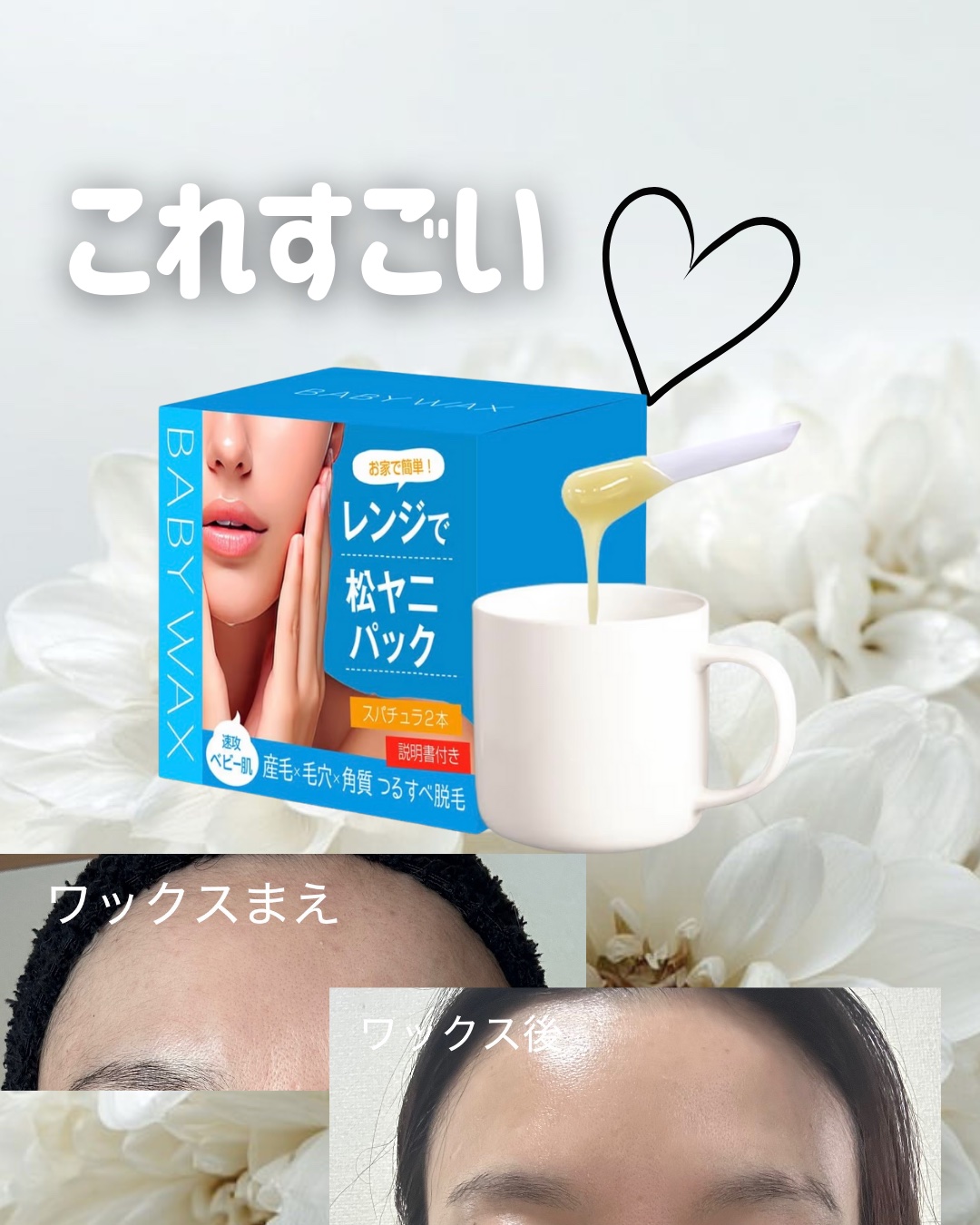 REPICA リピカ マツヤニパックのクチコミ「産毛除去ワックスのマツヤニパック✨

産毛除去するだけでくすんで見える肌が
飛んで、ツヤが出ま.....」（1枚目）