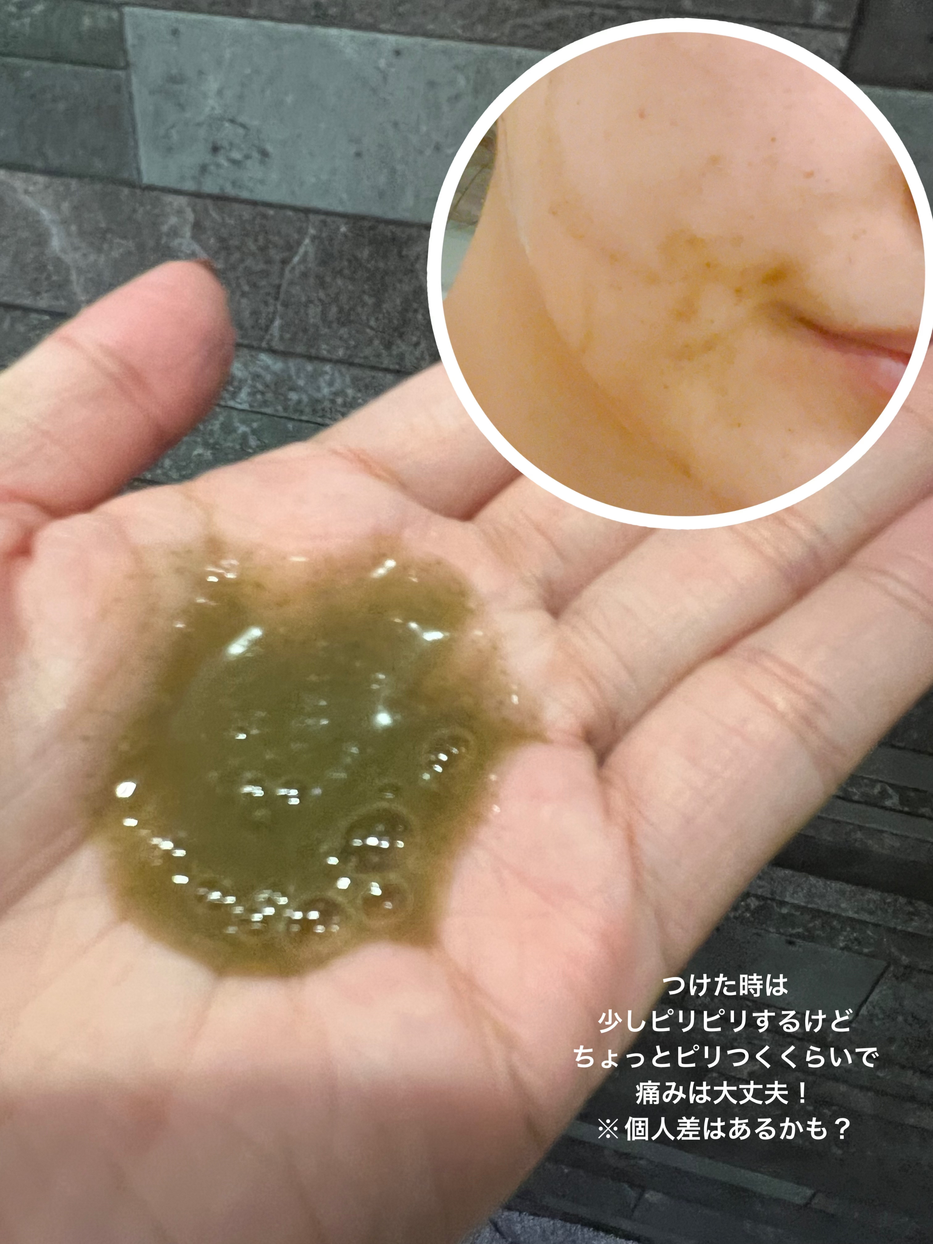 ハーブピーリング/on:myskin/ピーリングを使ったクチコミ（3枚目）