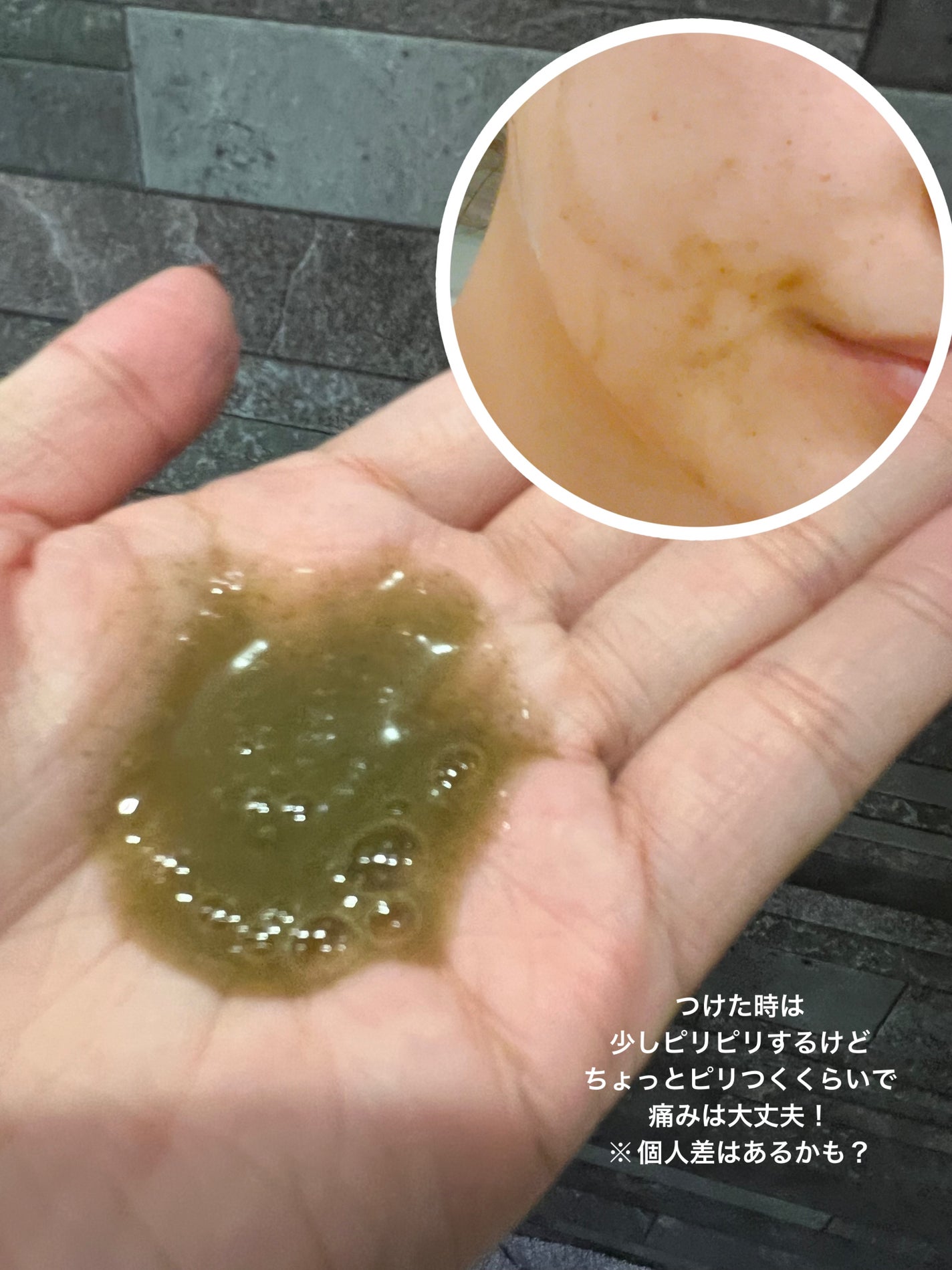 ハーブピーリング/on:myskin/ピーリングを使ったクチコミ(3枚目)