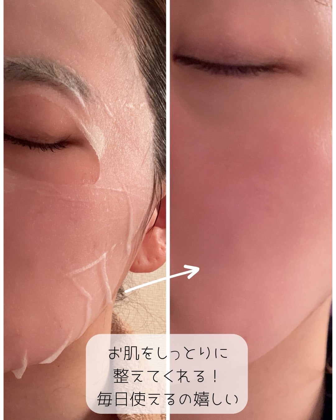 ã¿ããð°ïŸïœ«ïŸïŸïŸð¯ãã£ããè¿ããŸã on LIPS ãäžèº«ãè©°ãæ¿ãã§ãã倧容éã·ãŒãããã¯âŒïžMEDIHEALãã..ãïŒ5æç®ïŒ