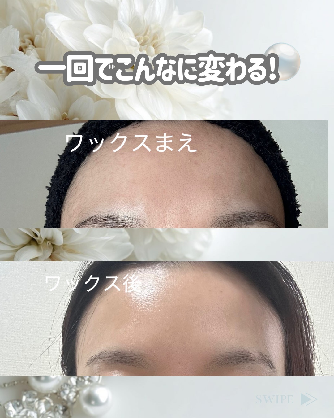 REPICA リピカ マツヤニパックのクチコミ「産毛除去ワックスのマツヤニパック✨

産毛除去するだけでくすんで見える肌が
飛んで、ツヤが出ま.....」（3枚目）