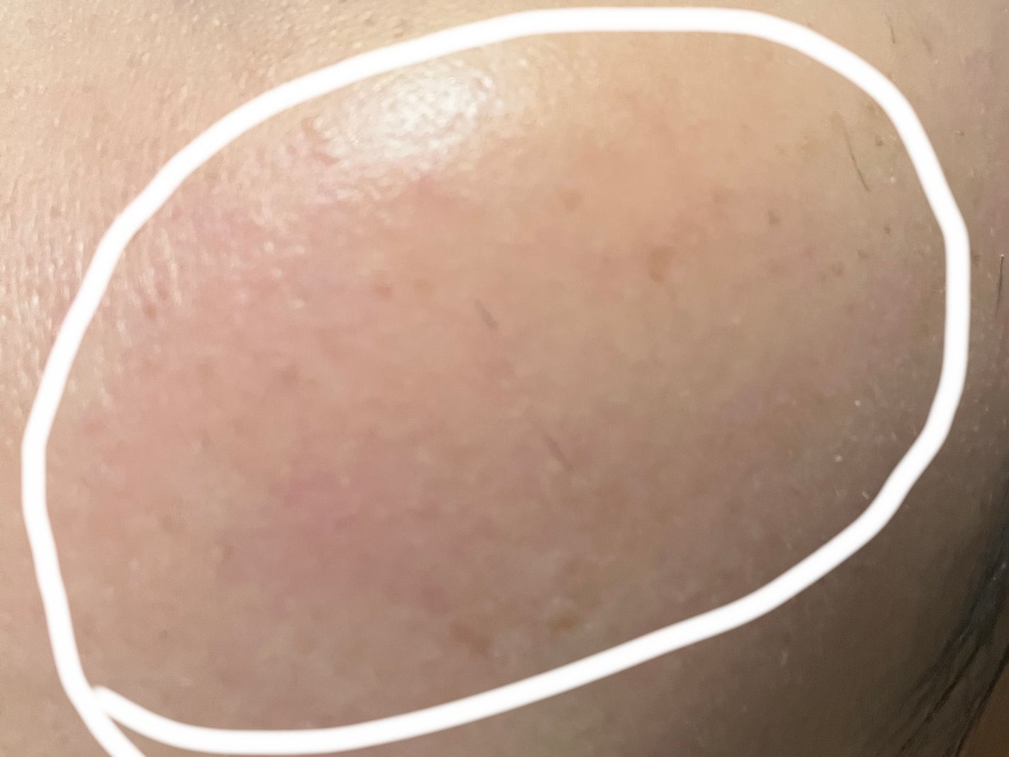 バックステージ ロージー グロウ スティック/Dior/チークを使ったクチコミ(5枚目)