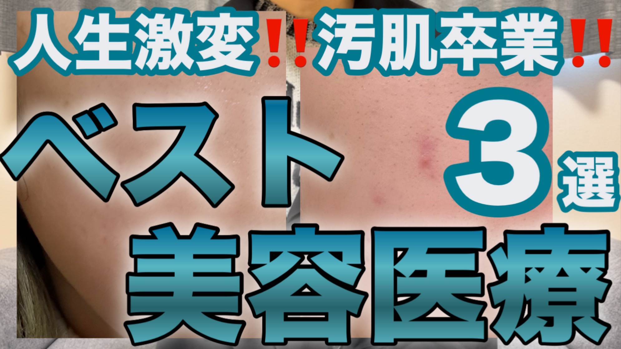 YouTube投稿しました✩.*˚

#美容医療 #美容皮膚科 #インナードライ