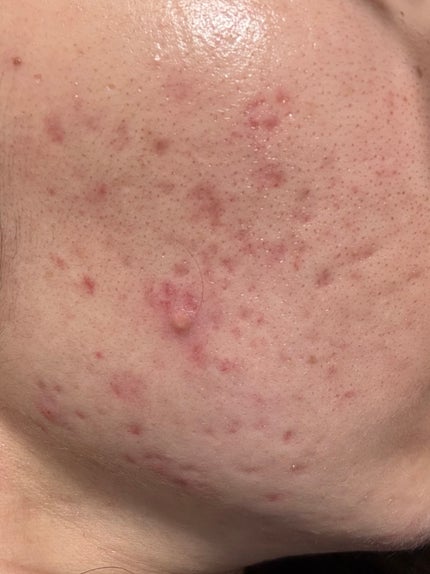 を使ったクチコミ(1枚目)