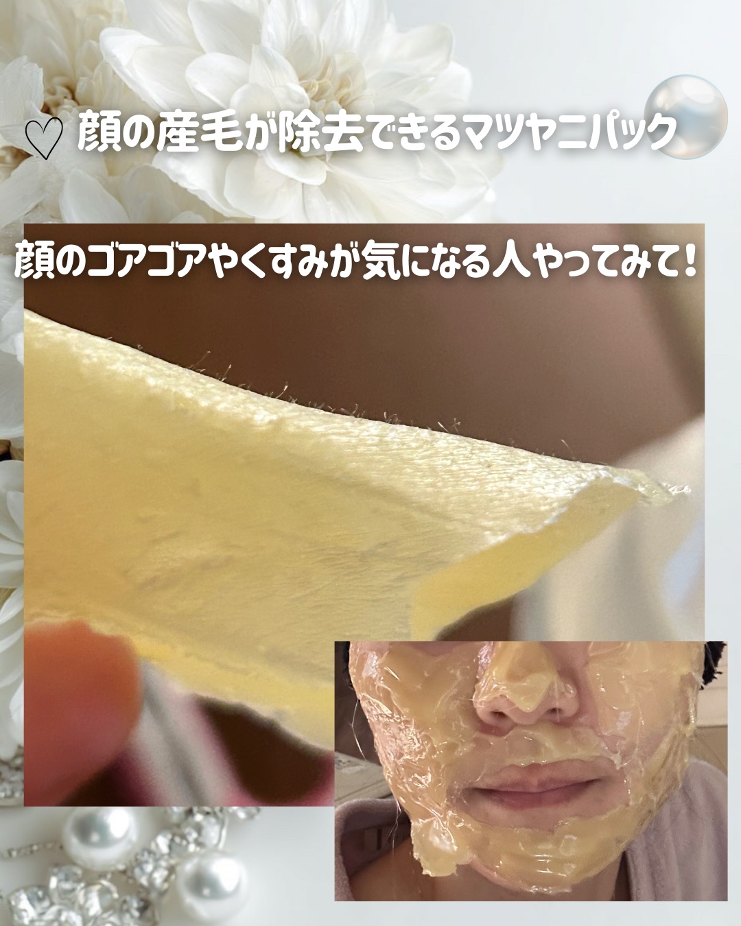 REPICA リピカ マツヤニパックのクチコミ「産毛除去ワックスのマツヤニパック✨

産毛除去するだけでくすんで見える肌が
飛んで、ツヤが出ま.....」（2枚目）