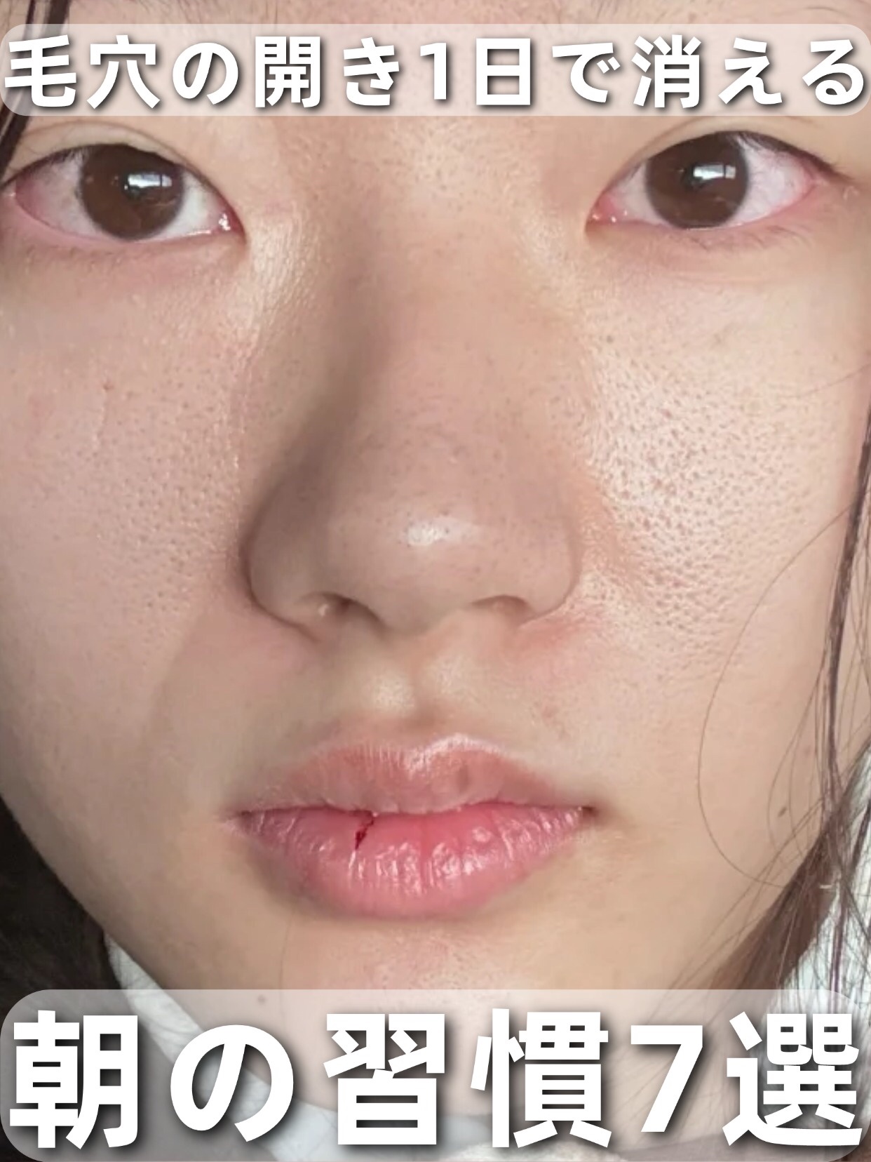 アネトス バランシング トリートメントクリーム/Anetos/フェイスクリームを使ったクチコミ（1枚目）