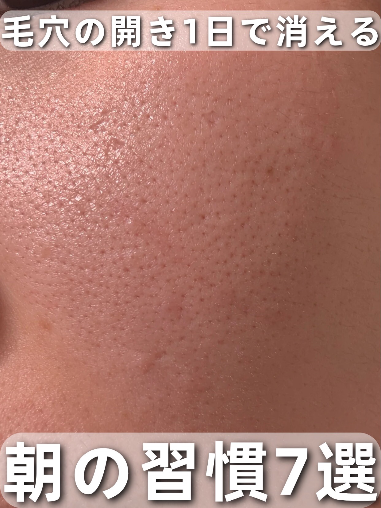 アネトス バランシング トリートメントクリーム/Anetos/フェイスクリームを使ったクチコミ（1枚目）