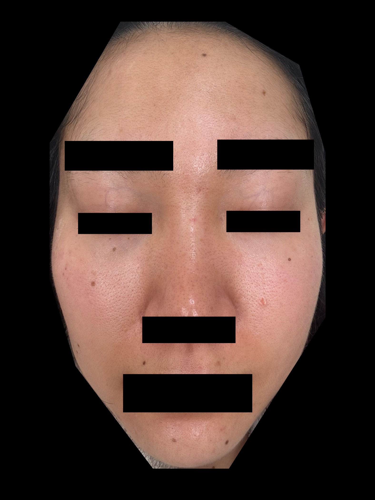 ホワイトショット ホワイトショット SXS Nのクチコミ「過去一汚い。。
何とかしたいな。。
Hakuを戻すか。。..」（1枚目）