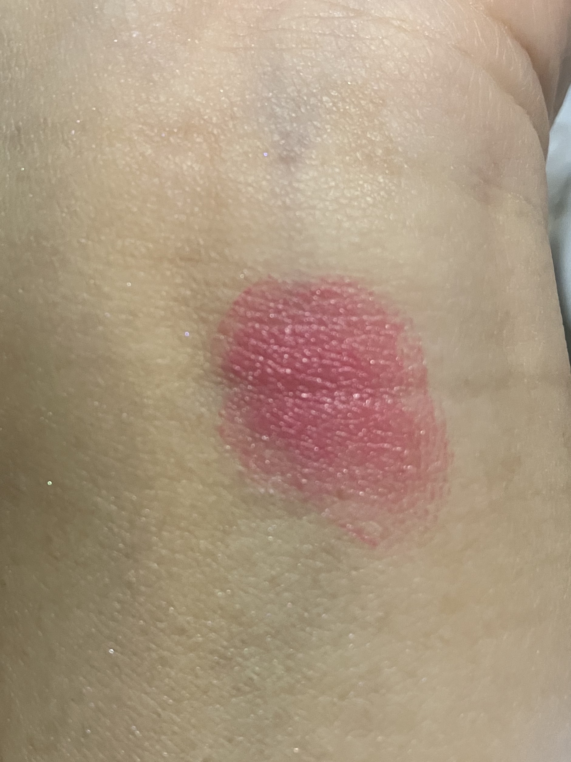 バックステージ ロージー グロウ スティック 831 ウルトラ ピンク（スプリング コレクション 2026 限定色）/Dior/チークを使ったクチコミ（3枚目）