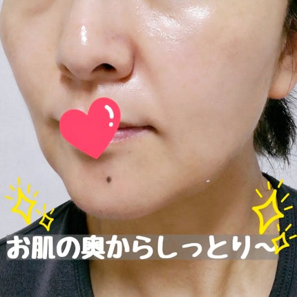 フルフィットプロポリスシナジートナー/COSRX/化粧水を使ったクチコミ(5枚目)