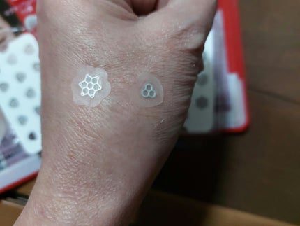 ACマグネシウムパッチ/スノーツープラス/シートマスク・パックを使ったクチコミ(6枚目)