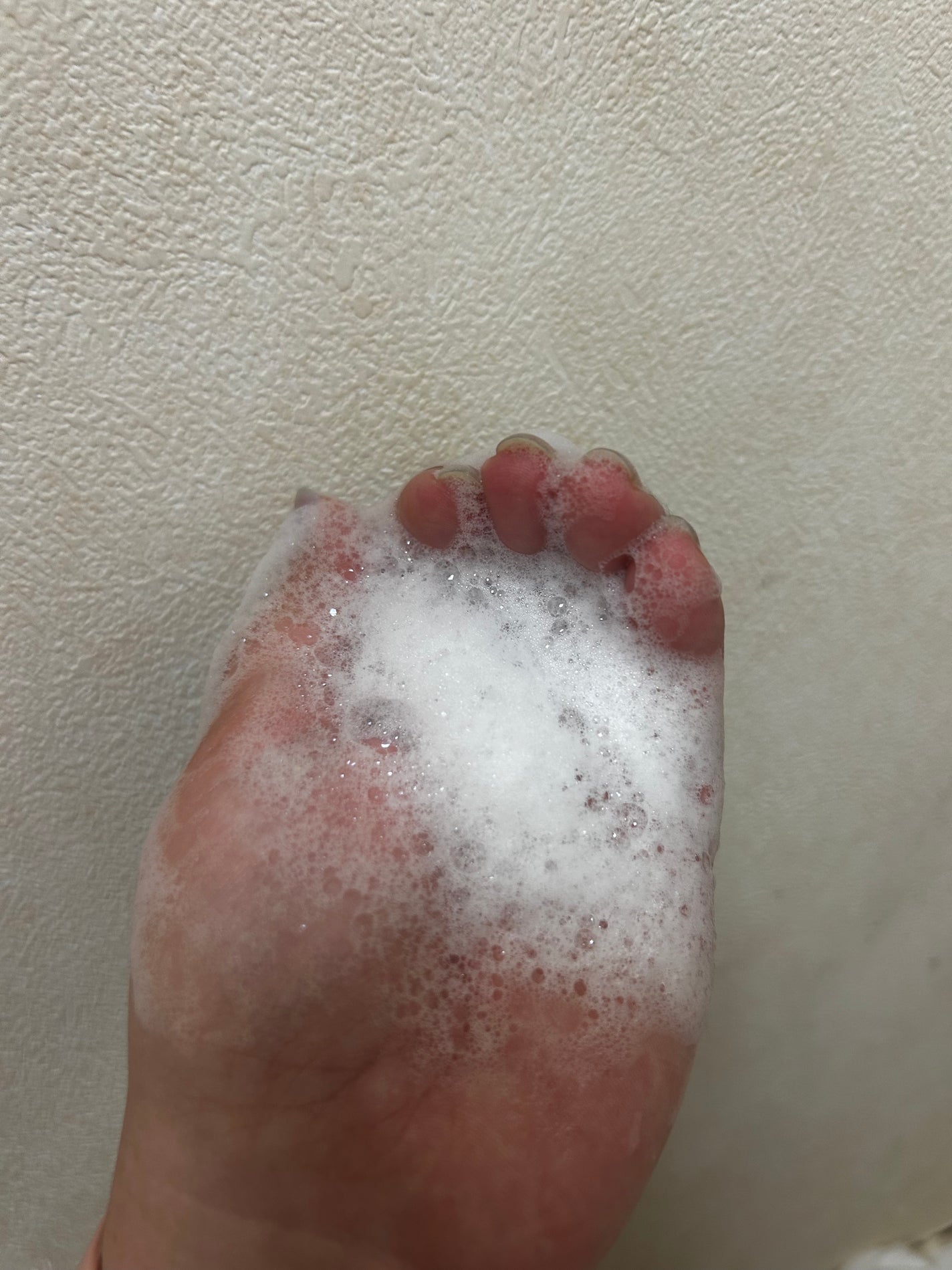 ナイアシンアミド 5% ボディローション/b.clinicx/ボディローションを使ったクチコミ(5枚目)