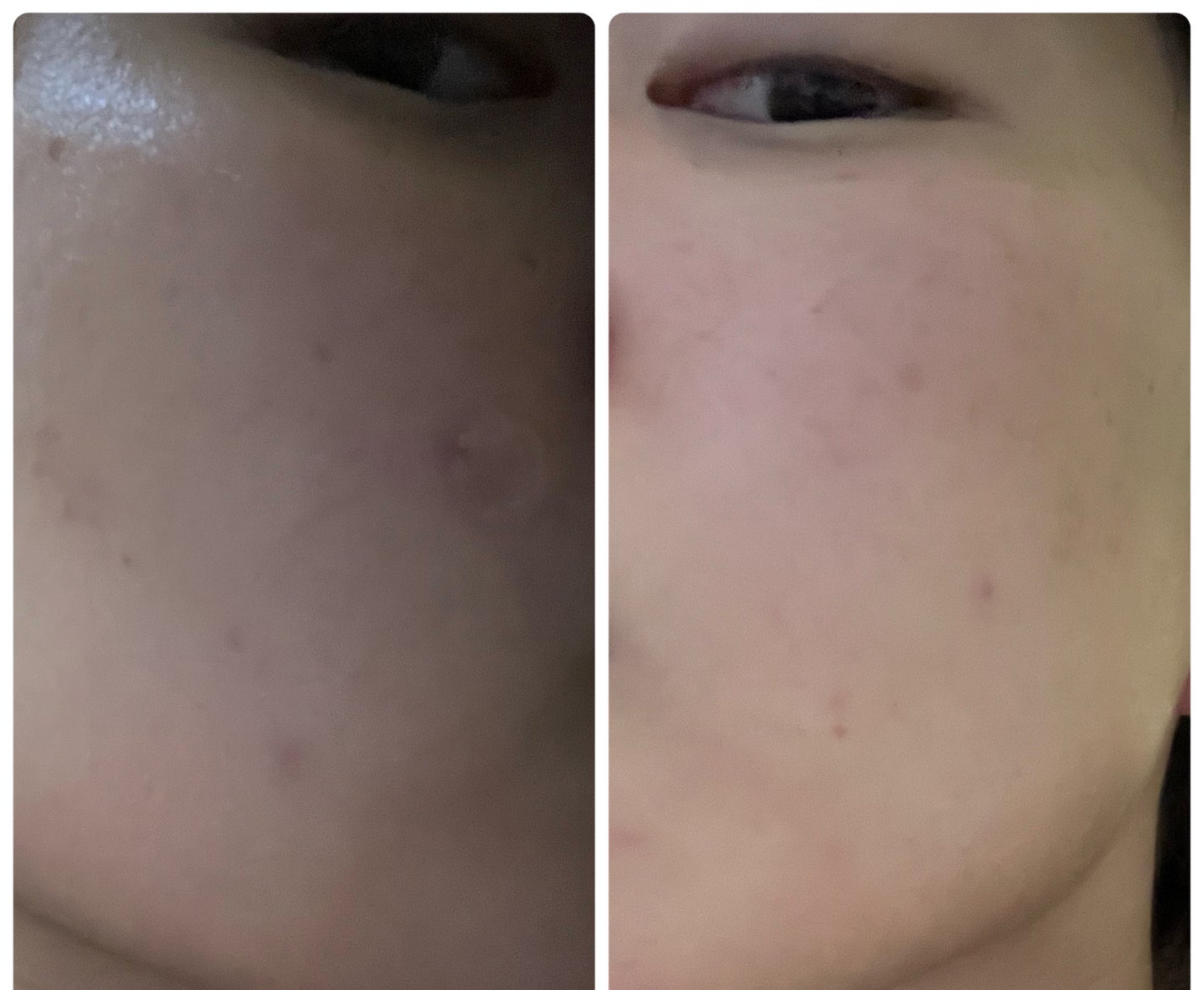 ぽむ on LIPS 「1枚目 2026.1.1エピデュオ 841日目2枚目 2026..」(5枚目)