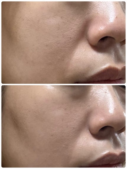 グラインディングコンシールバター/LUNA/クリームコンシーラーを使ったクチコミ(5枚目)