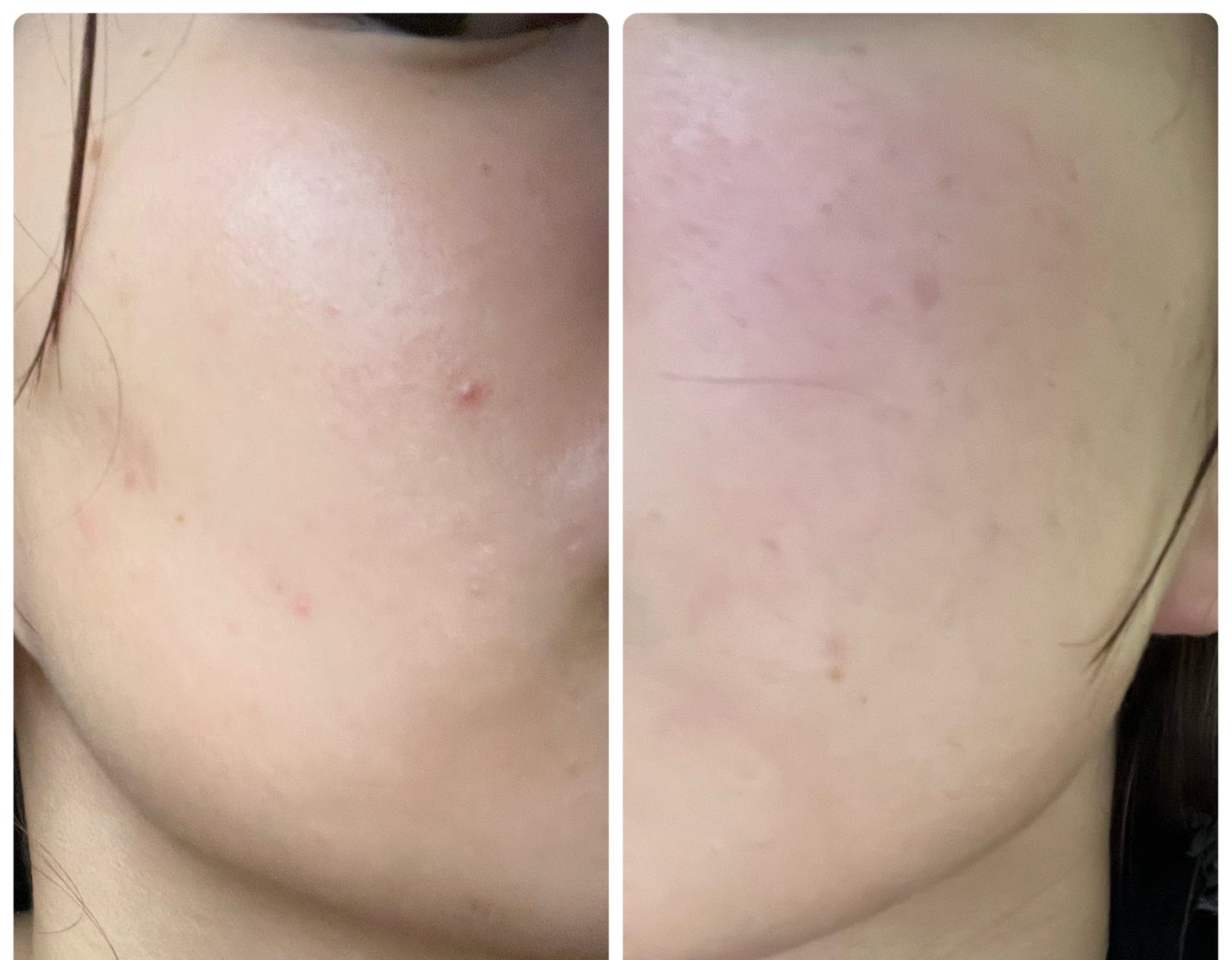 ぽむ on LIPS 「1枚目 2026.1.1エピデュオ 841日目2枚目 2026..」(4枚目)