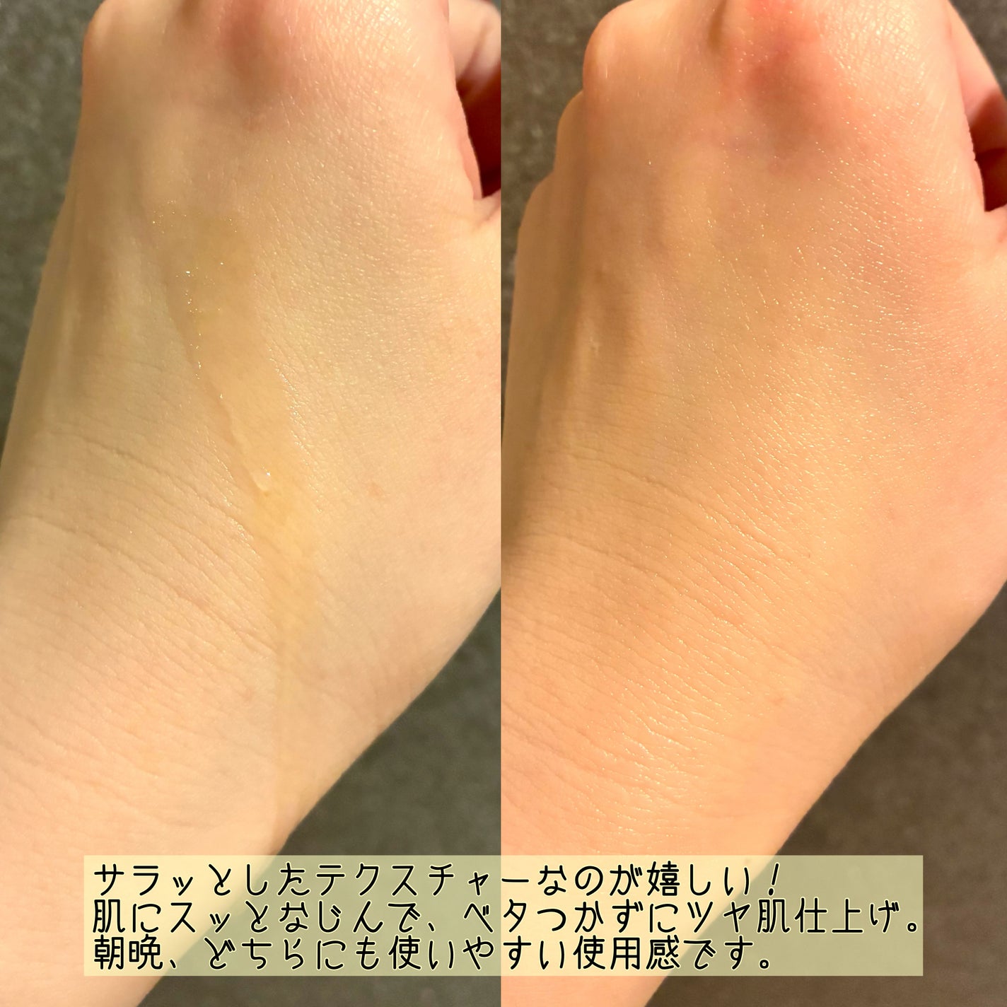 アゼライン酸CICA37セラム/オーズナリー/美容液を使ったクチコミ(4枚目)