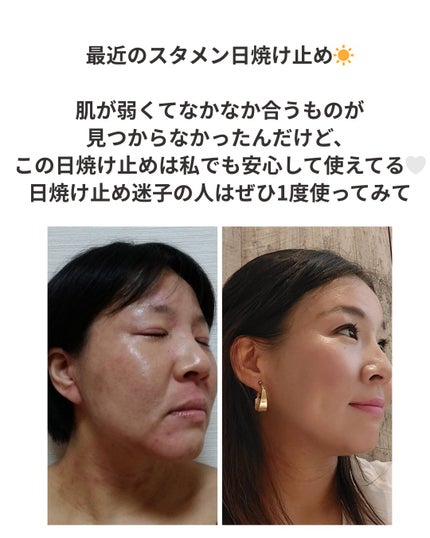 重度のアトピーを克服した40代美容家 on LIPS 「【肌弱さん必見!】ブルーライトまで防げる日焼け止め「日焼け..」(4枚目)