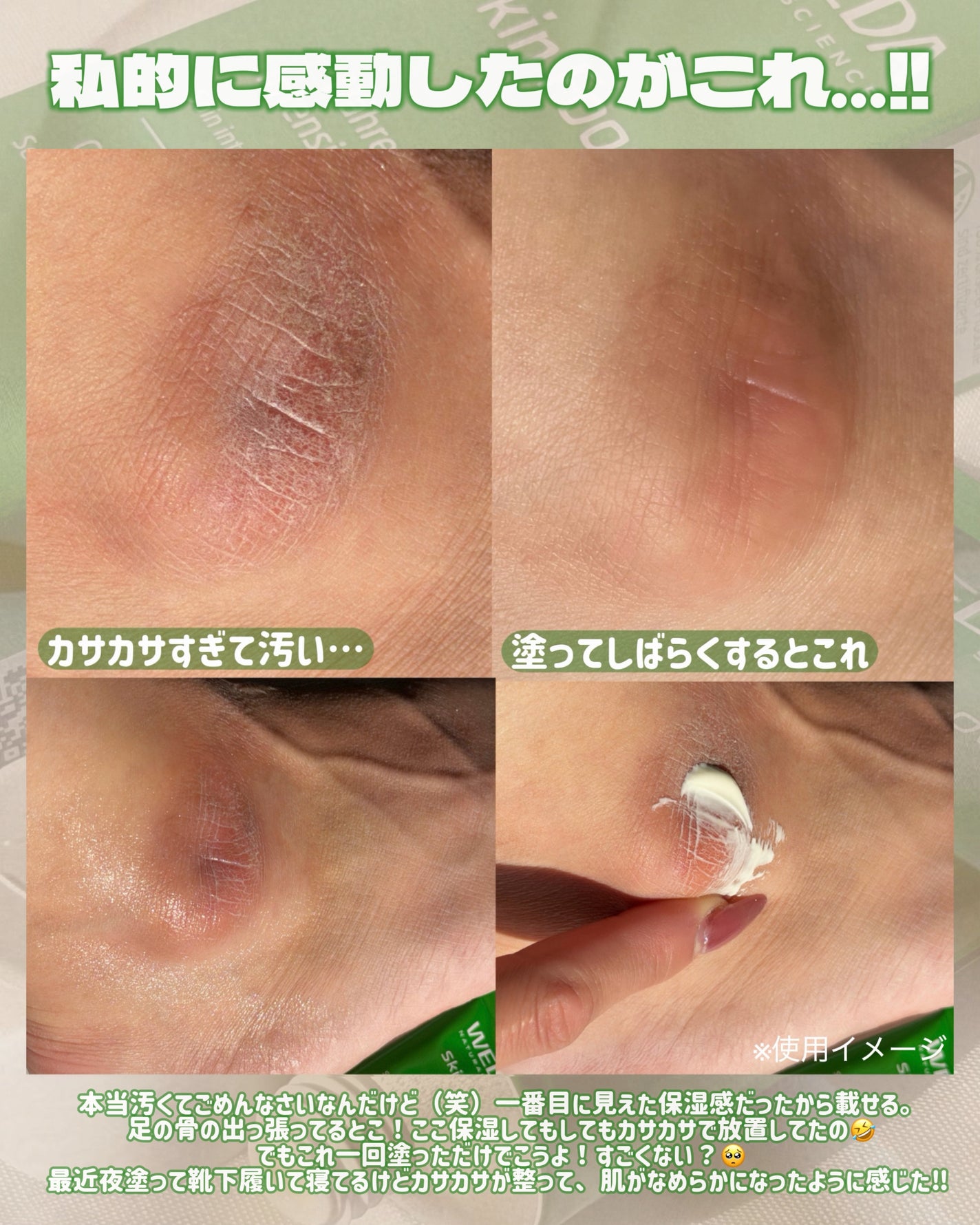 スキンフード /WELEDA/ボディクリームを使ったクチコミ(4枚目)