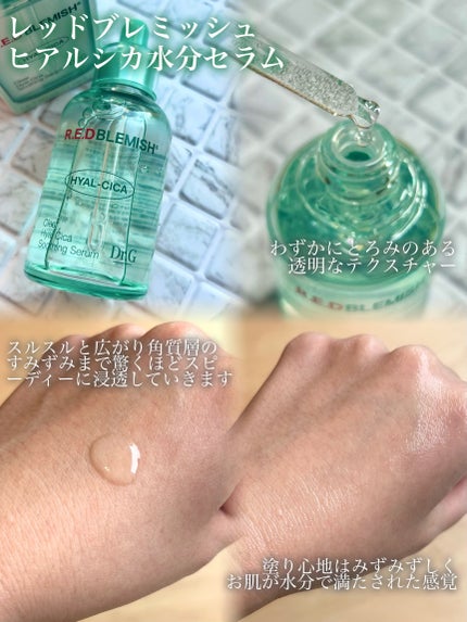 レッドブレミッシュ クリアスージングクリーム/Dr.G/フェイスクリームを使ったクチコミ(2枚目)