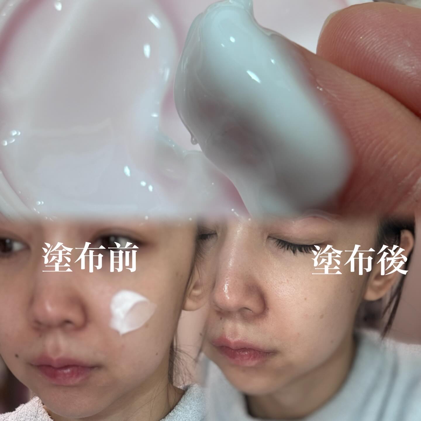 ピンクティーツリークリーム/APLIN/フェイスクリームを使ったクチコミ（2枚目）