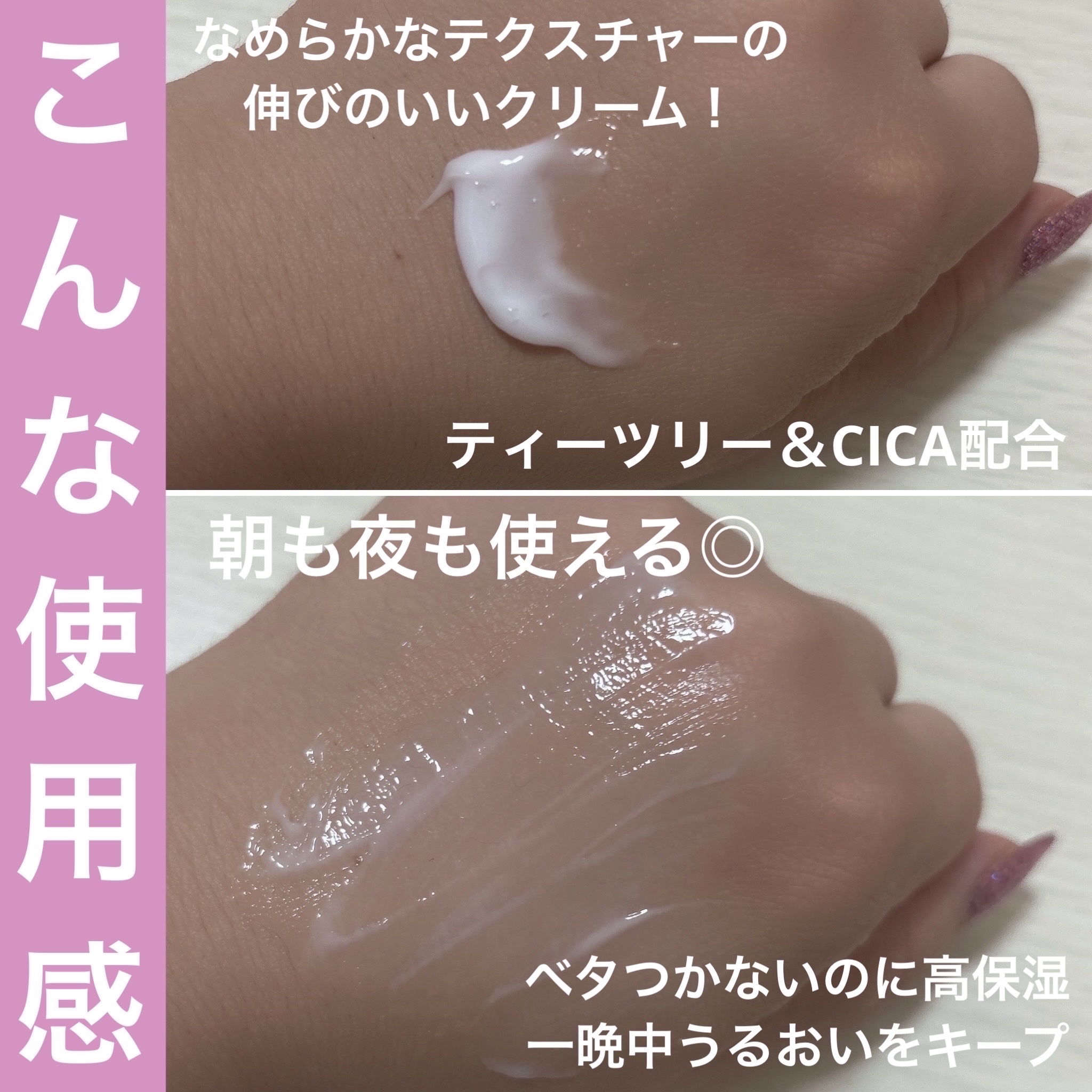 ピンクティーツリークリーム/APLIN/フェイスクリームを使ったクチコミ（3枚目）