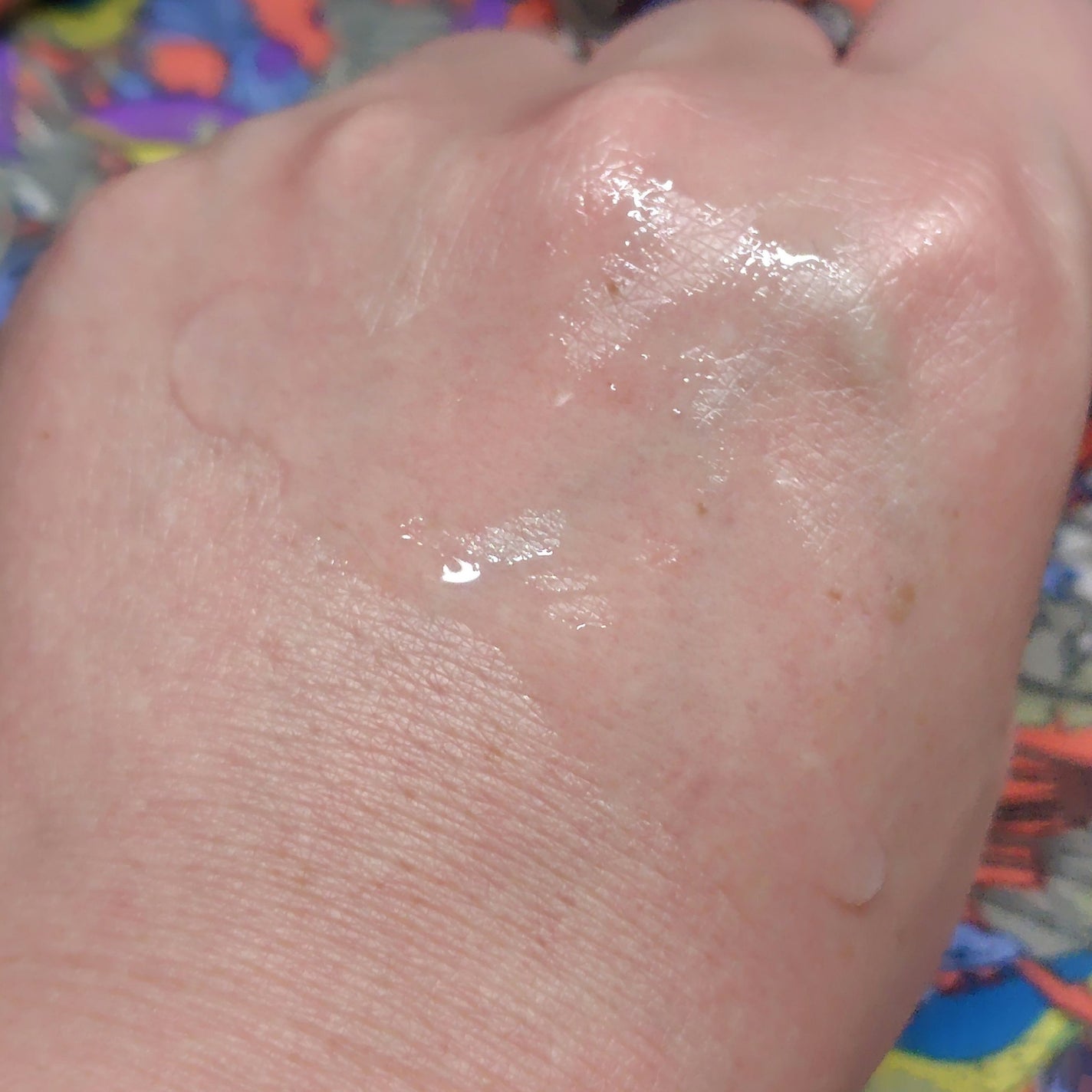 オイデルミン エッセンスローション/SHISEIDO/化粧水を使ったクチコミ(5枚目)