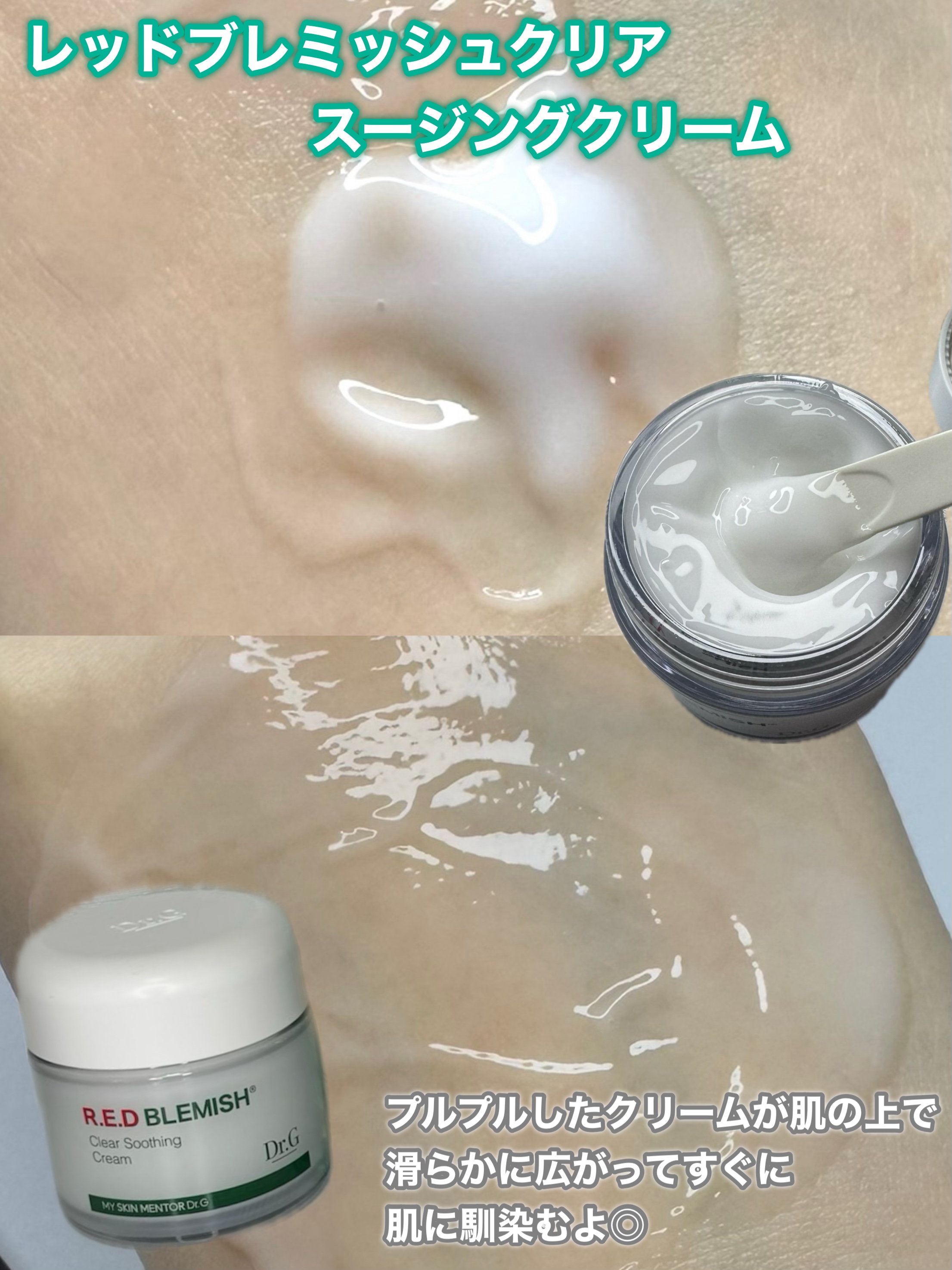 レッドブレミッシュ クリアスージングクリーム/Dr.G/フェイスクリームを使ったクチコミ（2枚目）