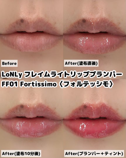 フレイムライトリッププランパー/LoNLy /リッププランパーを使ったクチコミ(2枚目)