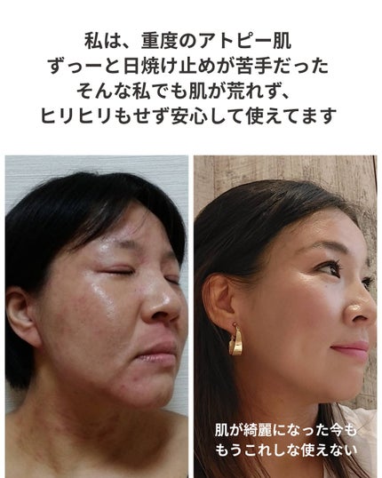 を使ったクチコミ(2枚目)