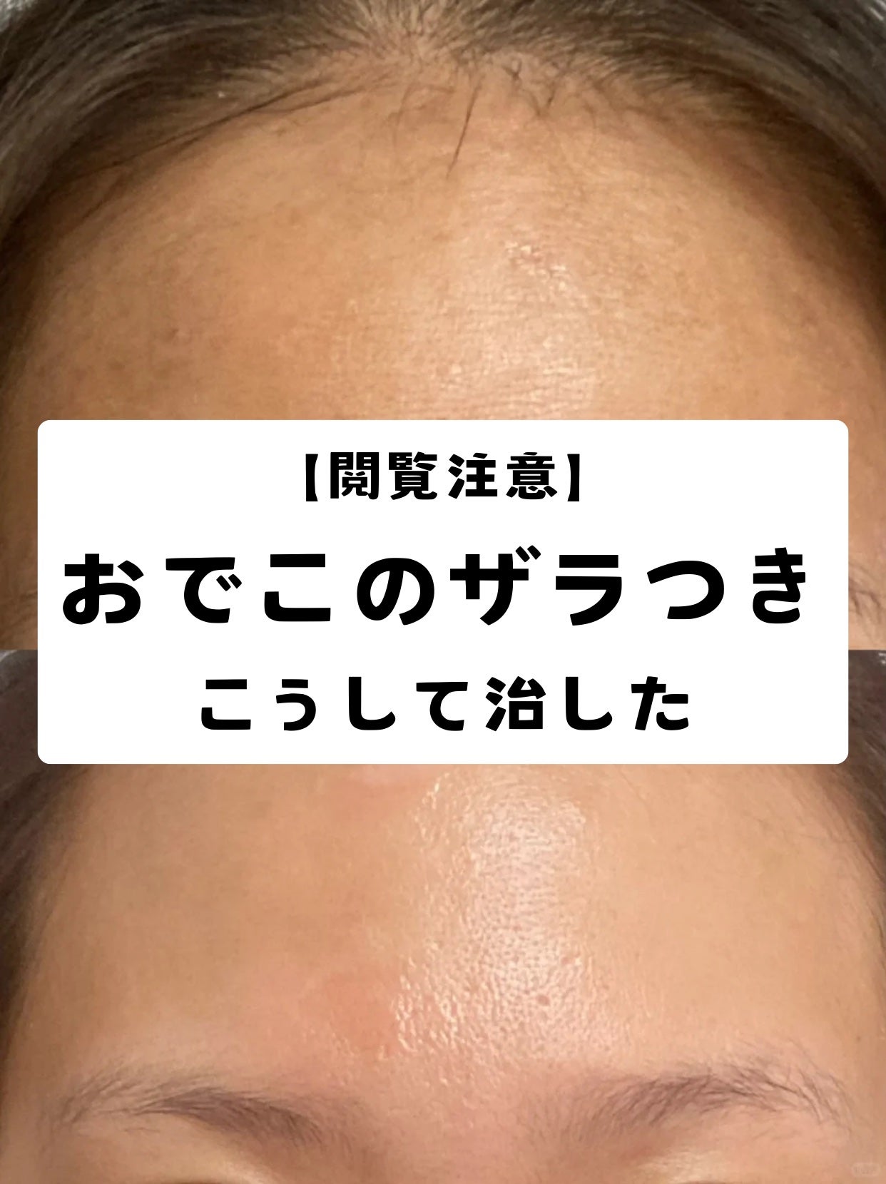 リードルショット100/VT/美容液を使ったクチコミ(1枚目)