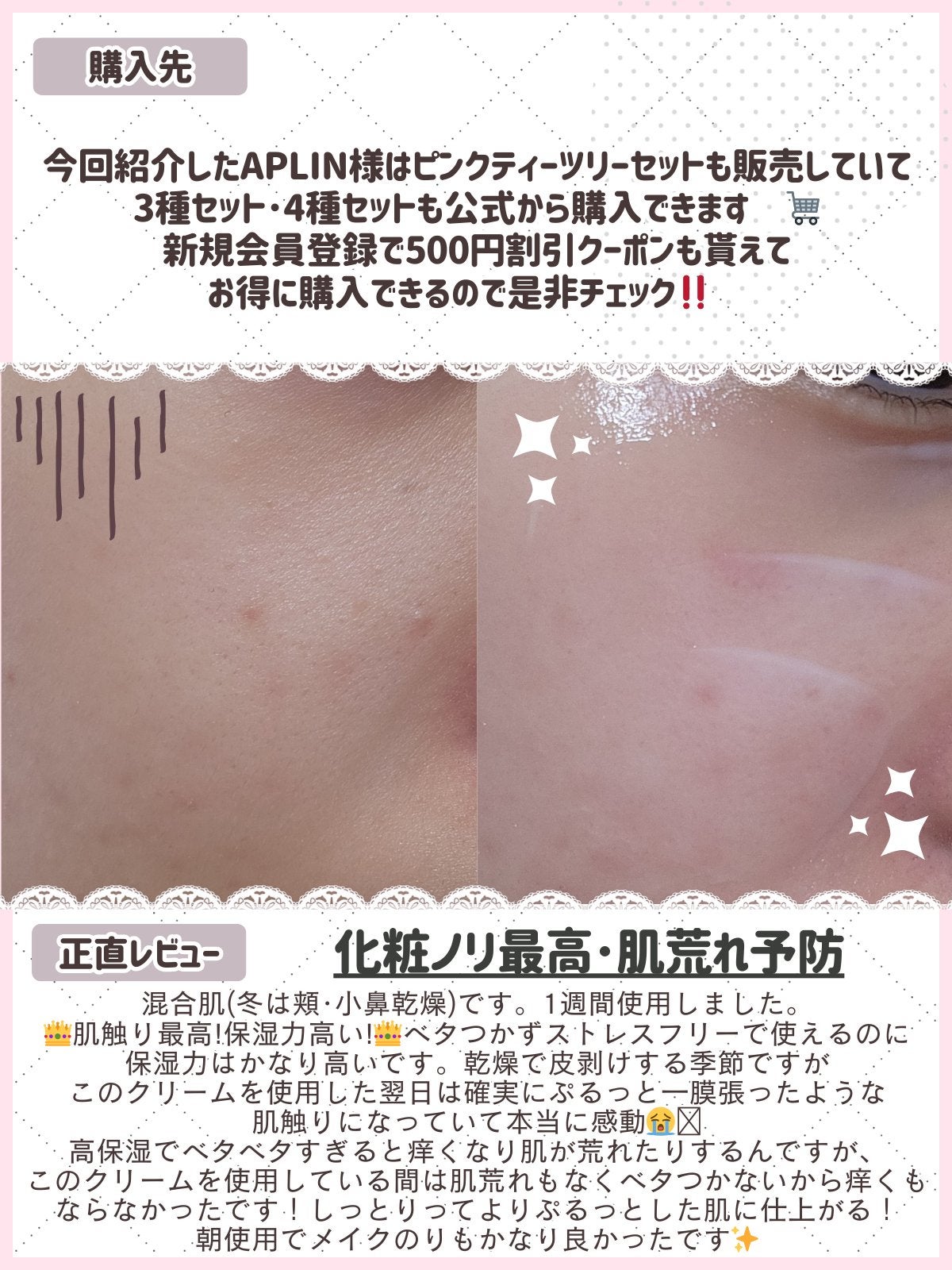 ピンクティーツリークリーム/APLIN/フェイスクリームを使ったクチコミ(3枚目)