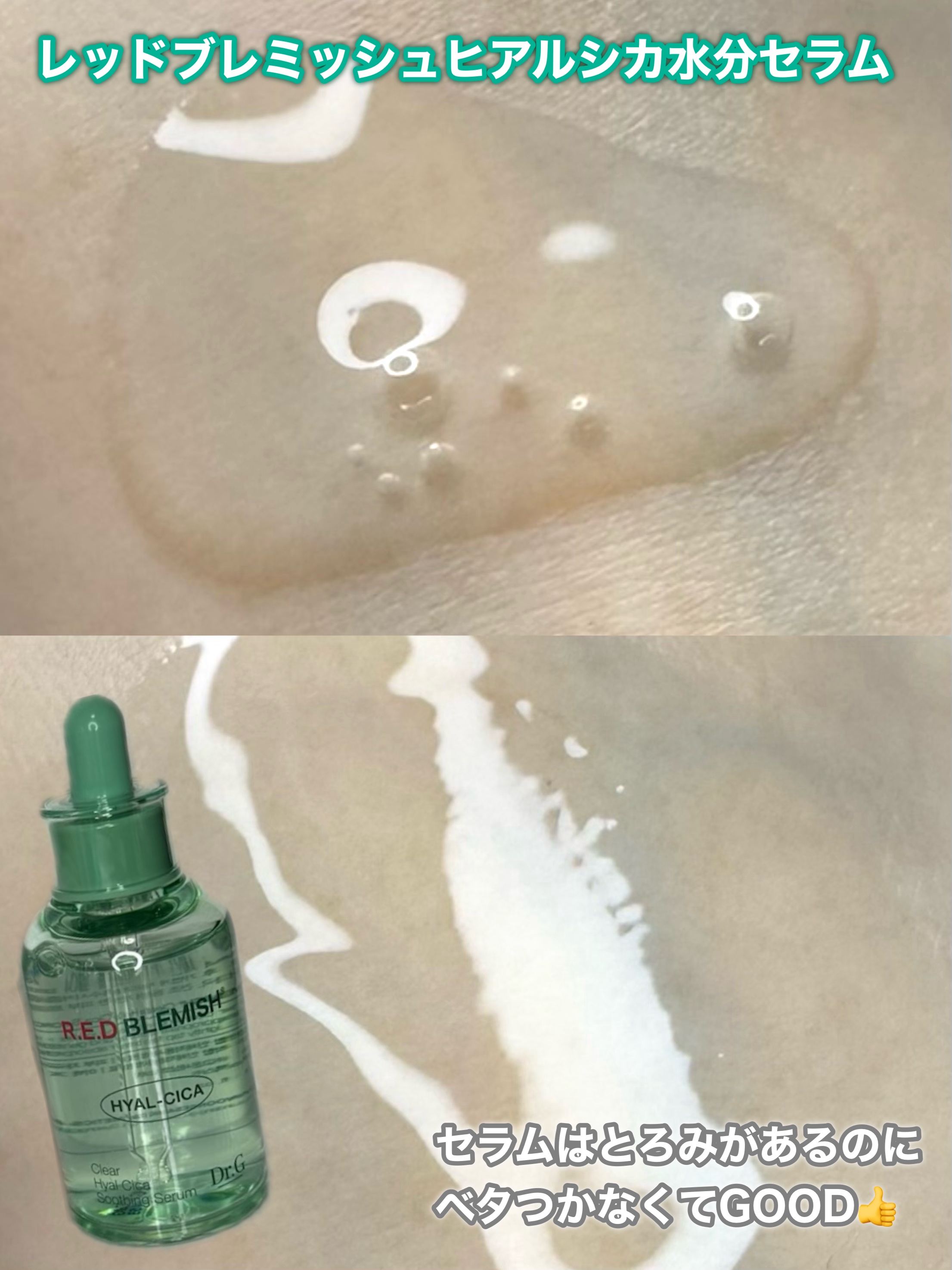 レッドブレミッシュ クリアスージングクリーム/Dr.G/フェイスクリームを使ったクチコミ（3枚目）