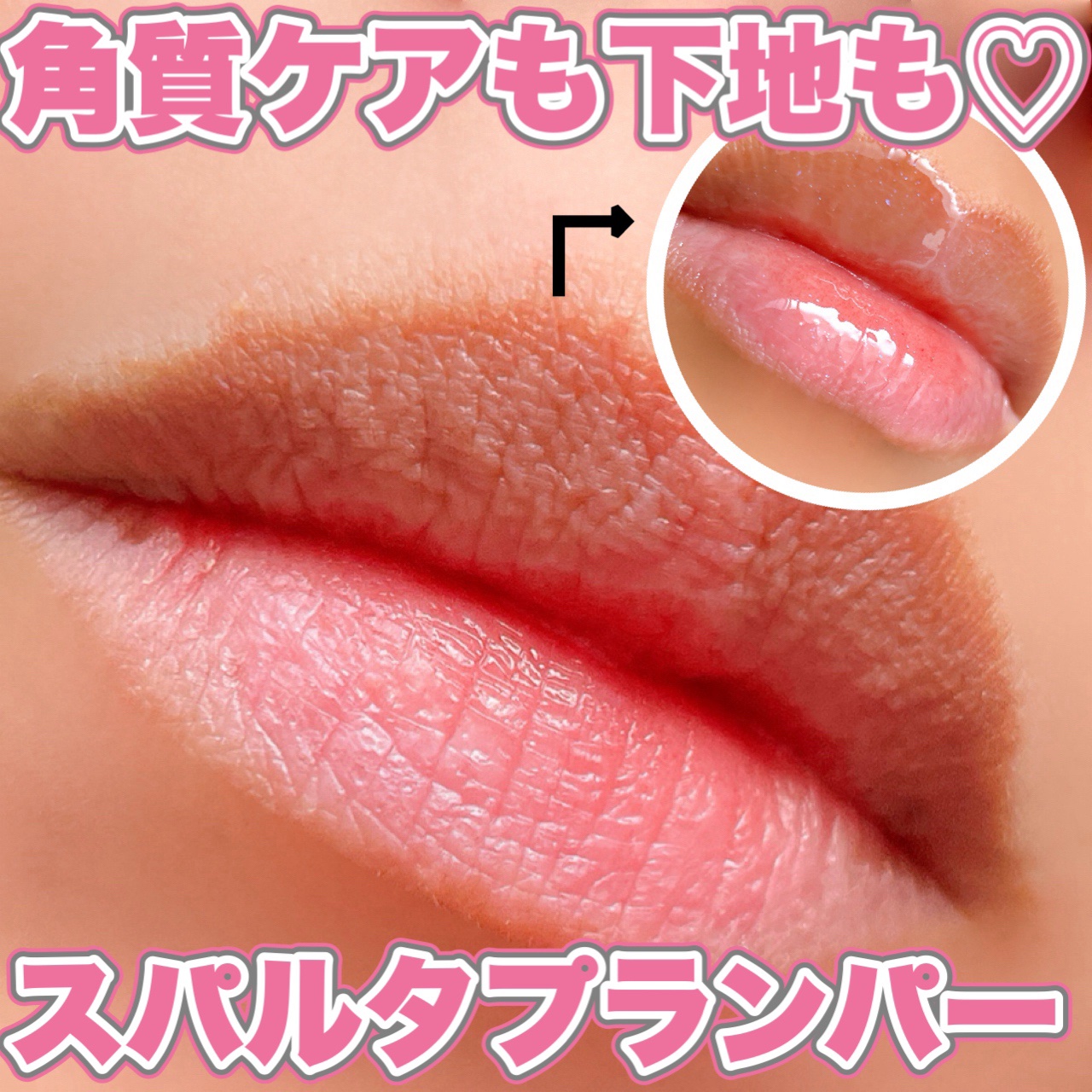 フレイムライトリッププランパー/LoNLy /リッププランパーを使ったクチコミ（1枚目）