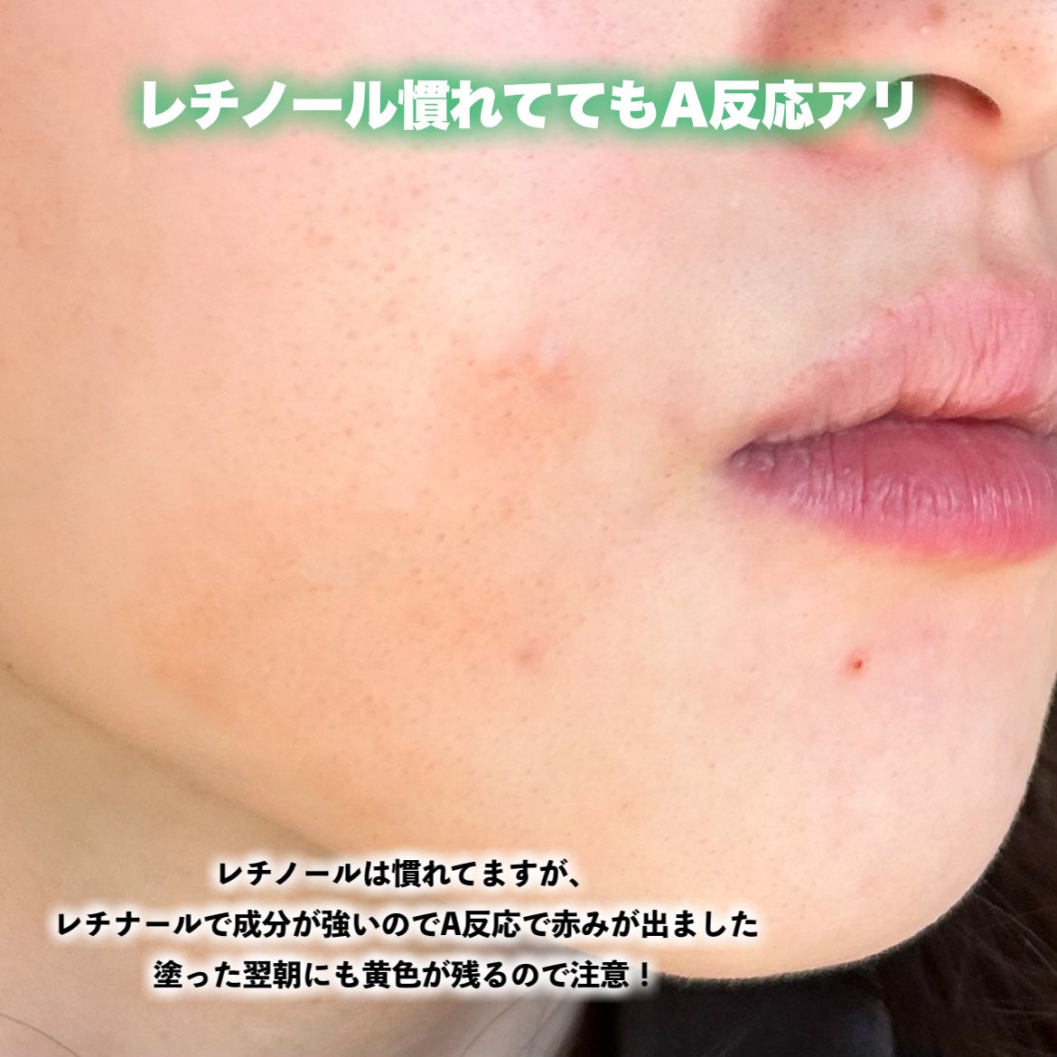 THE ビタA レチナールショット タイトニングブースター/celimax/ブースター・導入液を使ったクチコミ(4枚目)