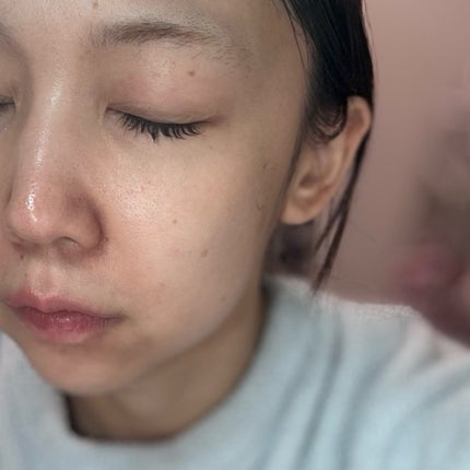 ピンクティーツリークリーム/APLIN/フェイスクリームを使ったクチコミ(4枚目)