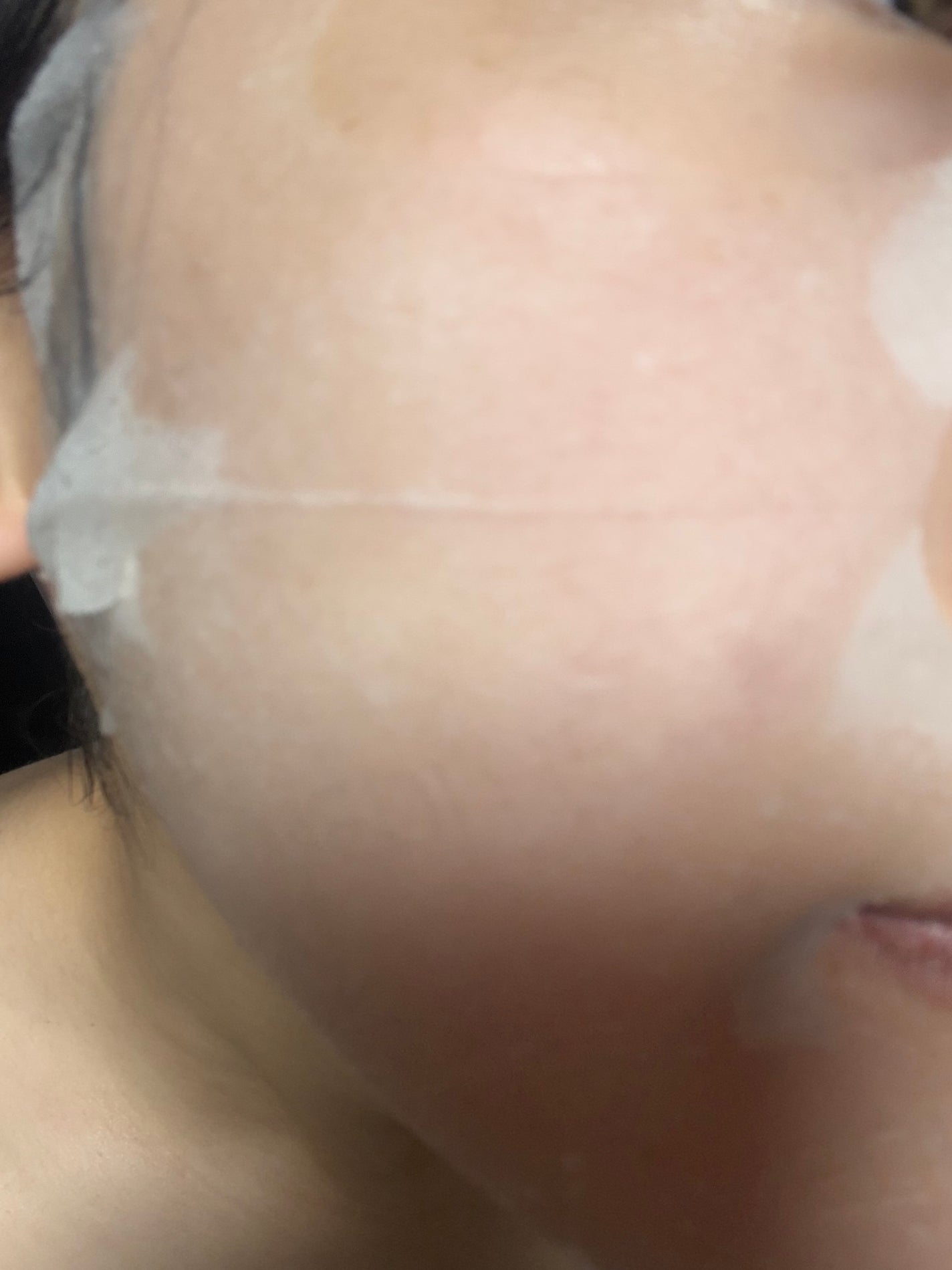 MEDIHEAL ティーツリー ケアソリューション エッセンシャルマスク EX /MEDIHEAL/シートマスク・パックを使ったクチコミ(2枚目)