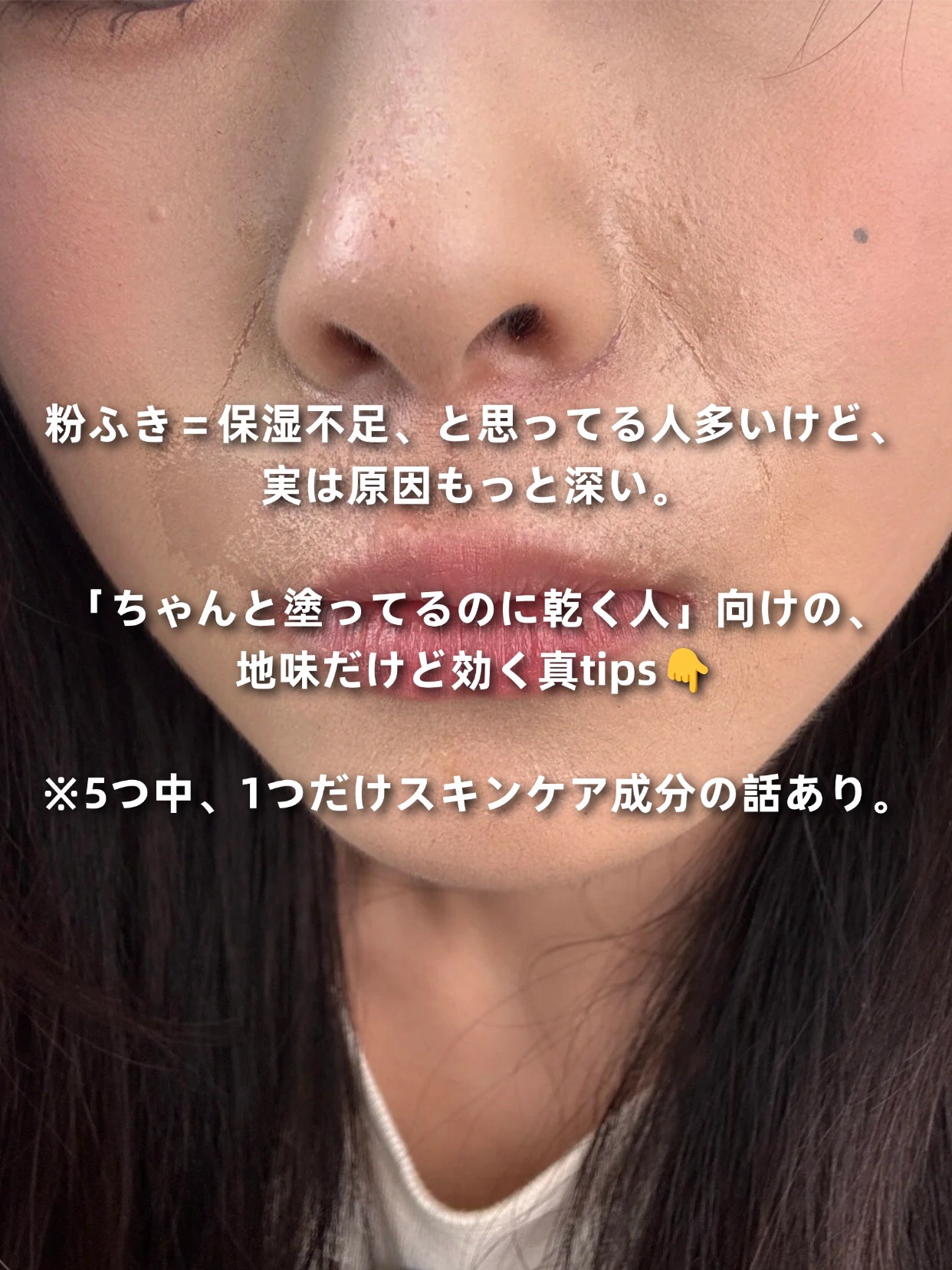 アネトス バランシング トリートメントクリーム/Anetos/フェイスクリームを使ったクチコミ（2枚目）